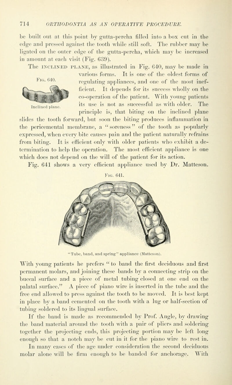 Fig. 640. be built out at this ])()iut by gutta-])crcha filled iuto a box cut in the edtj^e and ])ress('d at2:ainst the tooth while .still soft. Tiie rubber may be ligated on the outer edue of the gutta-percha, which may be increased in amount at each visit (Fig. 639). The I^X'LINED pi.anp:, as illustrated in Fig. 640, may be made in various forms. It is on(» of the oldest forms of regulating appliances, and one of the most inef- ficient. It depends for its success wholly on the co-operation of the patient. With young })atients its use is not as successful as with older. The principle is, that biting on the inclined plane slides the tooth forward, but soon the biting produces inflammation in the pericemental membrane, a  soreness of the tooth as pojmlarly expressed, when every bite causes pain and the patient naturally refrains from biting. It is efficient only with older patients who exhibit a de- termination to help the operation. The most efficient appliance is one which does not depend on the will of the patient for its action. Fig. 641 shows a very efficient appliance used by Dr. Matteson. Fig. 641. Tube, band, and spring appliance (Matteson). With young patients he prefers  to band the first deciduous and first permanent molars, and joining these bands by a connecting strip on the buccal surface and a piece of metal tubing closed at one end on the palatal surface. A piece of piano wire is inserted in the tube and the free end allowed to press against the tooth to be moved. It is best kept in place by a band cemented on the tooth with a lug or half-section of tubing soldered to its lingual surface. If the band is made as recommended by Prof. Angle, by drawing the band material around the tooth with a pair of pliers and soldering together the projecting ends, this projecting portion may be left long enough so that a notch may be cut in it for the piano wire to rest in. In many cases of the age under consideration the second deciduous molar alone will be firm enough to be banded for anchorage. With