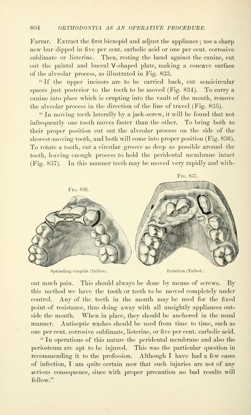 Farrar. Extract the first bicuspid and adjust the appliance; use a sharp now bur dipped in five per cent, carbolic acid or one per cent, corrosive sublimate or listerine. Then, resting the hand against the canine, cut out the palatal and buccal V-shaped plate, making a concave surfiice of the alveolar process, as illustrated in Fig. 833. If the upper incisors are to be carried back, cut semicircular spaces just posterior to the teeth to be moved (Fig. 834). To carry a canine into place which is erupting into the vault of the mouth, remove the alveolar process in the direction of the line of travel (Fig. 835).  In moving teeth laterally by a jack-screw, it will be found that not infrequently one tooth moves faster than the other. To bring both to their proper position cut out the alveolar process on the side of the slowest-moving tooth, and both will come into proper position (Fig. 836). To rotate a tooth, cut a circular groove as deep as possible around the tooth, leaving enough process to hold the peridental membrane intact (Fig. 837). In this manner teeth may be moved very rapidly and witli- FiG. 837. Fig. 836. Spreading cuspids (Talbut). Rotation (Talbot). out much pain. This should always be done by means of screws. By this method we have the tooth or teeth to be moved completely under control. Any of the teeth in the mouth may be used for the fixed point of resistance, thus doing away with all unsightly appliances out- side the mouth. When in place, they should be anchored in the usual manner. Antiseptic washes should be used from time to time, such as one per cent, corrosive sublimate, listerine, or five per cent, carbolic acid.  In operations of this nature the peridental membrane and also the periosteum are apt to be injured. This was the particular question in recommending it to the profession. Although I have had a few cases of infection, I am quite certain now that such injuries are not of any serious consequence, since with proper precaution no bad results will follow.