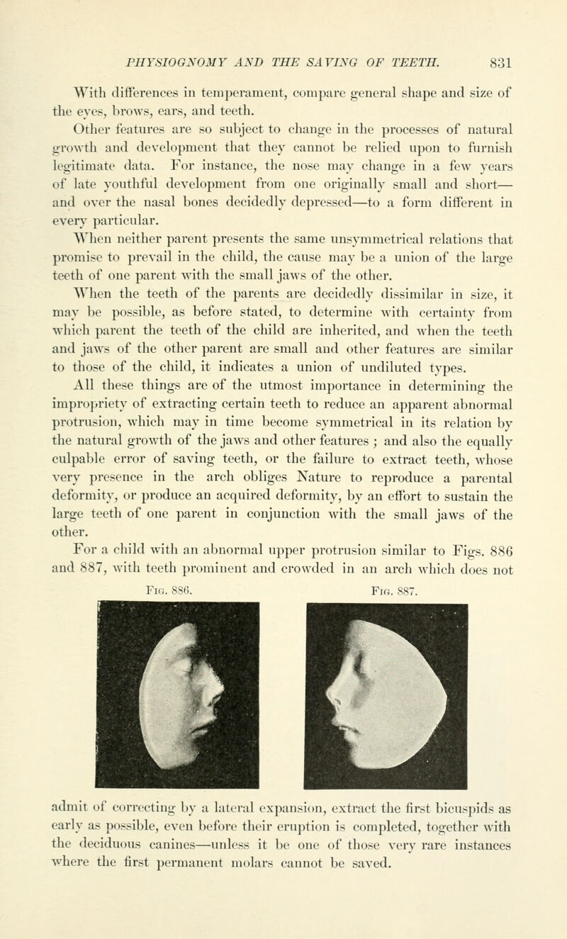 With differences in temperament, compare general shape and size of the eyes, brows, ears, and teeth. Other features are so subject to change in the processes of natural growth and development that they cannot be relied upon to furnish legitimate data. For instance, the nose may change in a few years of late youthful development from one originally small and short— and over the nasal bones decidedly depressed—to a form different in every particular. When neither parent presents the same unsymmetrical relations that promise to prevail in the child, the cause may be a union of the large teeth of one parent with the small jaws of the other. When the teeth of the parents are decidedly dissimilar in size, it may be possible, as before stated, to determine with certainty from which parent the teeth of the child are inherited, and when the teeth and jaws of the other parent are small and other features are similar to those of the child, it indicates a union of undiluted types. All these things are of the utmost importance in determining the impropriety of extracting certain teeth to reduce an apparent abnormal protrusion, which may in time become symmetrical in its relation by the natural growth of the jaws and other features ; and also the equally culpable error of saving teeth, or the failure to extract teeth, whose very presence in the arch obliges Nature to reproduce a parental deformity, or produce an acquired deformity, by an effort to sustain the large teeth of one parent in conjunction with the small jaws of the other. For a child with an abnormal upper protrusion similar to Figs. 886 and 887, with teeth prominent and crowded in an arch which does not Fig. 886. Fig. 887. admit of correcting by a lateral expansion, extract the first bicuspids as early as possible, even before their eruption is completed, together with the deciduous canines—imless it be one of those very rare instances where the first permanent molars cannot be saved.