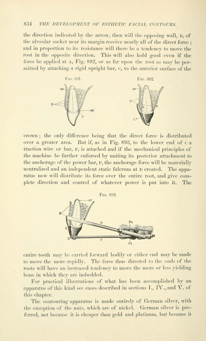 the direction iiulicated l)y the arrow, theii will the <)i)p().sing wall, i;, of the alveolar socket near its margin receive nearly all of the direct force ; and in j)roportion to its resistance will there be a tendency to move the root in the o])j)osite direction. This will also hold good even if the force be applied at a. Fig. 892, or as I'ar upon the root as may be per- mitted by attaching a rigid npright bar, c, to the anterior surface of the B-^ crown ; the only difference being that the direct force is distributed over a greater area. But if, as in Fig. 893, to the lower end of c a traction wire or bar, f, is attached and if the mechanical principles of the machine be further enforced by uniting its posterior attachment to the anchorage of the power bar, p, the anchorage force will be materially neutralized and an independent static fulcrum at d created. The appa- ratus now will distribute its force over the entire root, and give com- plete direction and control of whatever power is put into it. The Fig. 893. entire tooth may be carried forward bodily or either end may be made to move the more rapidly. The force thus directed to the ends of the roots will have an increased tendency to move the more or less yielding bone in which they are imbedded. For practical illustrations of what has been accomplished by an apparatus of this kind see cases described in sections I., IV., and V. of this chapter. The contouring apparatus is made entirely of German silver, with the exception of the nuts, which are of nickel. German silver is pre- ferred, not because it is cheaper than gold and platinum, but because it