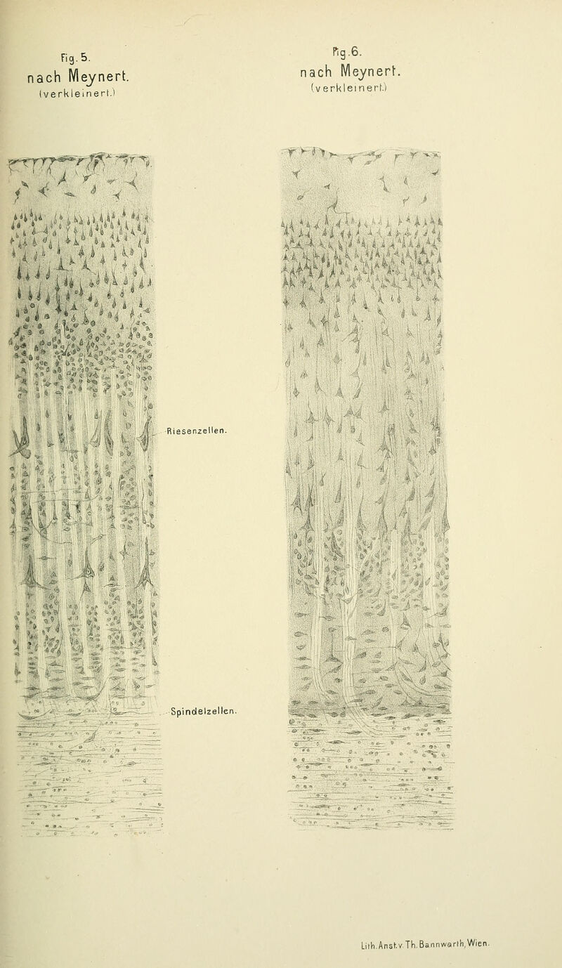 Fig. 5. nach IVleynert. (verkleinert.) ng.6. nach MeynerL (verkleinert) ■r^'n<rti r< ^v 'U, :«^„ '> k li : i i 4 tf! '^ •'(^ i. j- ^l*f 4^ Riesenzellen. Y- Spinolelzellen. :-i;^JgT.H*--S.'