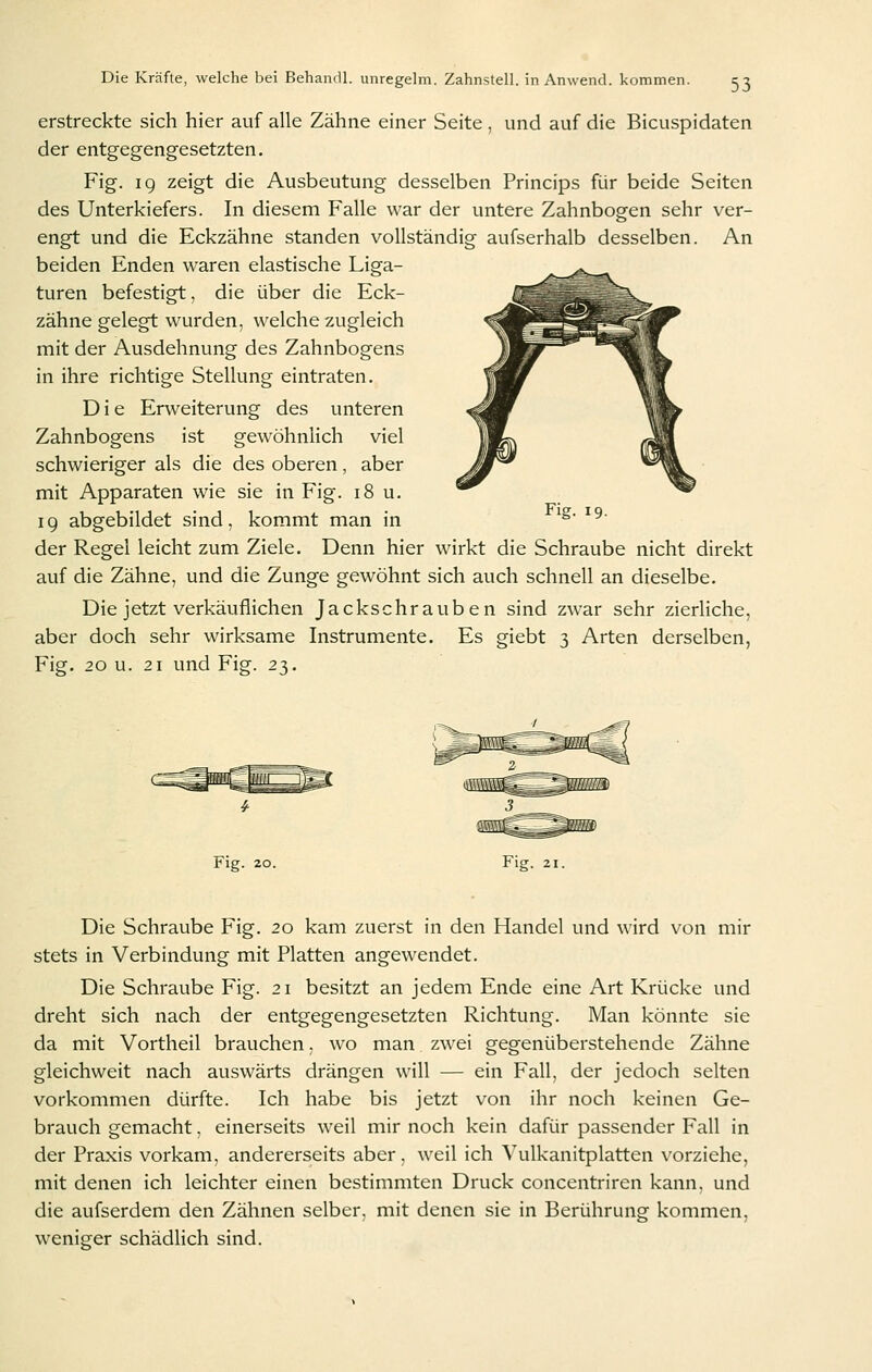 erstreckte sich hier auf alle Zähne einer Seite , und auf die Bicuspidaten der entgegengesetzten. Fig. 19 zeigt die Ausbeutung desselben Princips für beide Seiten des Unterkiefers. In diesem Falle war der untere Zahnbogen sehr ver- engt und die Eckzähne standen vollständig aufserhalb desselben. An beiden Enden waren elastische Liga- turen befestigt, die über die Eck- zähne gelegt wurden, welche zugleich mit der Ausdehnung des Zahnbogens in ihre richtige Stellung eintraten. D i e Erweiterung des unteren Zahnbogens ist gewöhnlich viel schwieriger als die des oberen, aber mit Apparaten wie sie in Fig. 18 u. 19 abgebildet sind, kommt man in ^^' ^^' der Regel leicht zum Ziele. Denn hier wirkt die Schraube nicht direkt auf die Zähne, und die Zunge gewöhnt sich auch schnell an dieselbe. Die jetzt verkäuflichen Jackschrauben sind zwar sehr zierliche, aber doch sehr wirksame Instrumente. Es giebt 3 Arten derselben, Fig. 20 u. 21 und Fig. 23. Fig. 20. Fig. 21. Die Schraube Fig. 20 kam zuerst in den Handel und wird von mir stets in Verbindung mit Platten angewendet. Die Schraube Fig. 21 besitzt an jedem Ende eine Art Krücke und dreht sich nach der entgegengesetzten Richtung. Man könnte sie da mit Vortheil brauchen, wo man zwei gegenüberstehende Zähne gleichweit nach auswärts drängen will — ein Fall, der jedoch selten vorkommen dürfte. Ich habe bis jetzt von ihr noch keinen Ge- brauch gemacht, einerseits weil mir noch kein dafür passender Fall in der Praxis vorkam, andererseits aber, weil ich Vulkanitplatten vorziehe, mit denen ich leichter einen bestimmten Druck concentriren kann, und die aufserdem den Zähnen selber, mit denen sie in Berührung kommen, weniger schädlich sind.