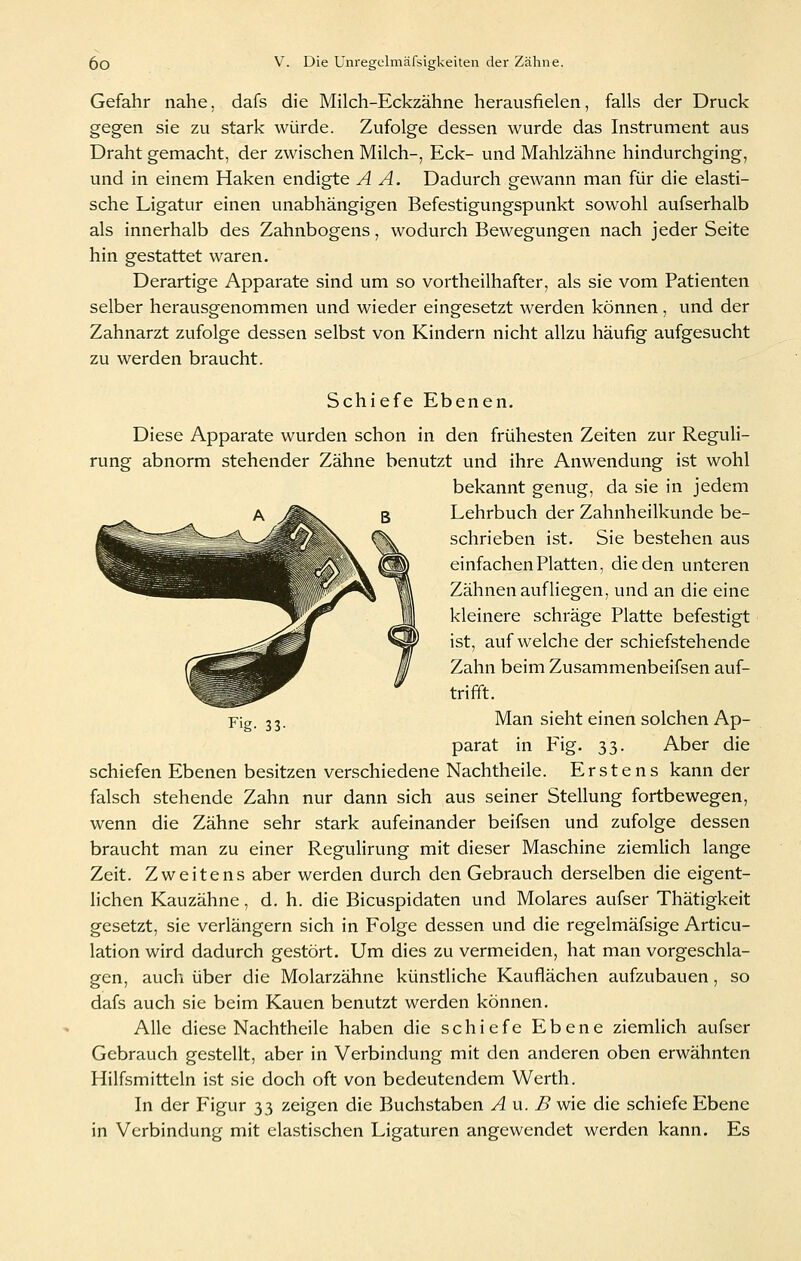 Gefahr nahe, dafs die Milch-Eckzähne herausfielen, falls der Druck gegen sie zu stark würde. Zufolge dessen wurde das Instrument aus Draht gemacht, der zwischen Milch-, Eck- und Mahlzähne hindurchging, und in einem Haken endigte A A. Dadurch gewann man für die elasti- sche Ligatur einen unabhängigen Befestigungspunkt sowohl aufserhalb als innerhalb des Zahnbogens, wodurch Bewegungen nach jeder Seite hin gestattet waren. Derartige Apparate sind um so vortheilhafter, als sie vom Patienten selber herausgenommen und wieder eingesetzt werden können, und der Zahnarzt zufolge dessen selbst von Kindern nicht allzu häufig aufgesucht zu werden braucht. Schiefe Ebenen. Diese Apparate wurden schon in den frühesten Zeiten zur Reguli- rung abnorm stehender Zähne benutzt und ihre Anwendung ist wohl bekannt genug, da sie in jedem Lehrbuch der Zahnheilkunde be- schrieben ist. Sie bestehen aus einfachen Platten, die den unteren Zähnen aufliegen, und an die eine kleinere schräge Platte befestigt ist, aufweiche der schiefstehende Zahn beim Zusammenbeifsen auf- trifft. Man sieht einen solchen Ap- parat in Fig. 33. Aber die schiefen Ebenen besitzen verschiedene Nachtheile. Erstens kann der falsch stehende Zahn nur dann sich aus seiner Stellung fortbewegen, wenn die Zähne sehr stark aufeinander beifsen und zufolge dessen braucht man zu einer Regulirung mit dieser Maschine ziemlich lange Zeit. Zweitens aber werden durch den Gebrauch derselben die eigent- lichen Kauzähne, d. h. die Bicuspidaten und Molares aufser Thätigkeit gesetzt, sie verlängern sich in Folge dessen und die regelmäfsige Articu- lation wird dadurch gestört. Um dies zu vermeiden, hat man vorgeschla- gen, auch über die Molarzähne künstliche Kauflächen aufzubauen, so dafs auch sie beim Kauen benutzt werden können. Alle diese Nachtheile haben die schiefe Ebene ziemHch aufser Gebrauch gestellt, aber in Verbindung mit den anderen oben erwähnten Hilfsmitteln ist sie doch oft von bedeutendem Werth. In der Figur 33 zeigen die Buchstaben An. B wie die schiefe Ebene in Verbindung mit elastischen Ligaturen angewendet werden kann. Es