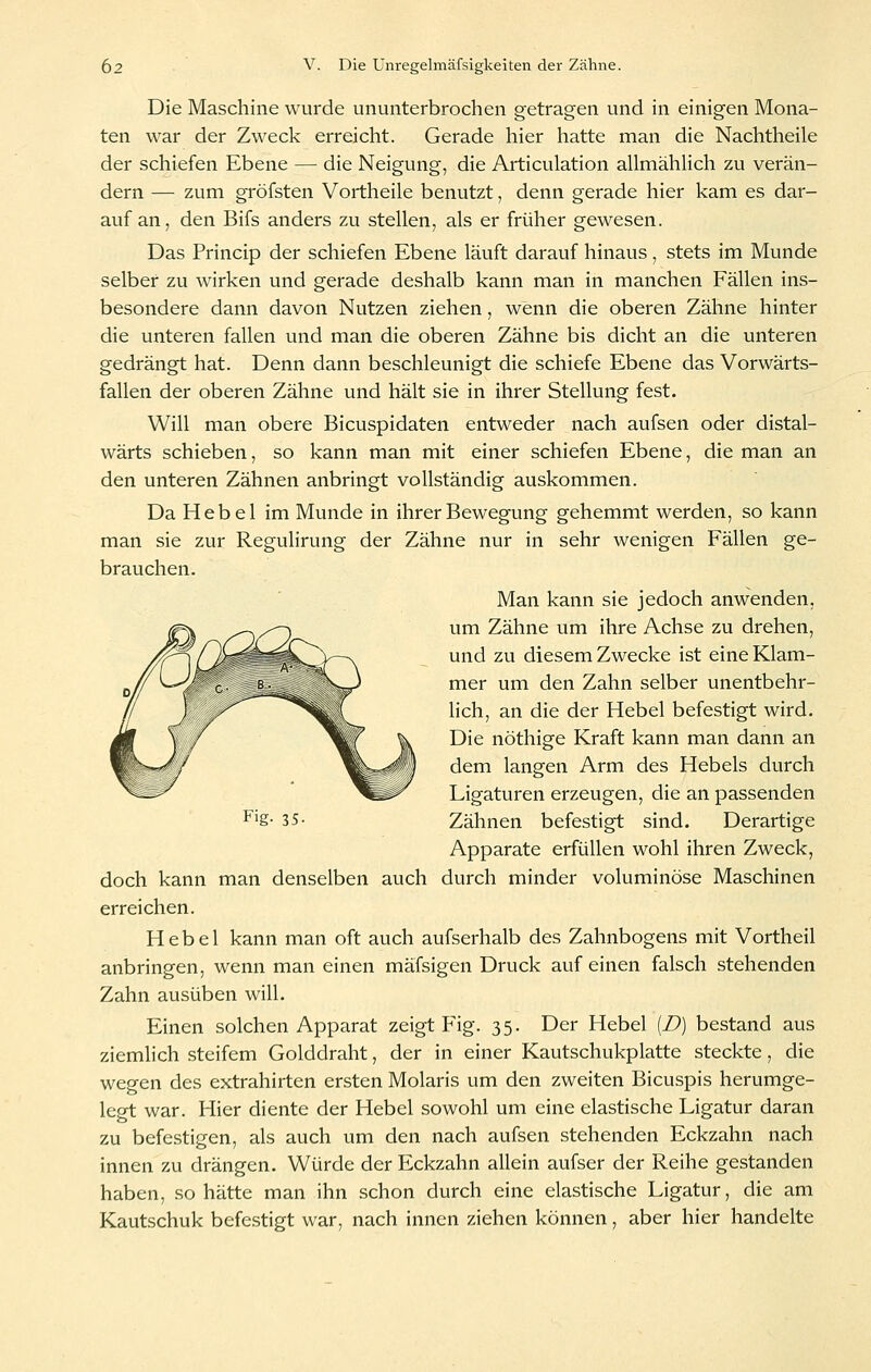 Die Maschine wurde ununterbrochen getragen und in einigen Mona- ten war der Zweck erreicht. Gerade hier hatte man die Nachtheile der schiefen Ebene — die Neigung, die Articulation allmähUch zu verän- dern — zum gröfsten Vortheile benutzt, denn gerade hier kam es dar- auf an, den Bifs anders zu stellen, als er früher gewesen. Das Princip der schiefen Ebene läuft darauf hinaus, stets im Munde selber zu wirken und gerade deshalb kann man in manchen Fällen ins- besondere dann davon Nutzen ziehen, wenn die oberen Zähne hinter die unteren fallen und man die oberen Zähne bis dicht an die unteren gedrängt hat. Denn dann beschleunigt die schiefe Ebene das Vorwärts- fallen der oberen Zähne und hält sie in ihrer Stellung fest. Will man obere Bicuspidaten entweder nach aufsen oder distal- wärts schieben, so kann man mit einer schiefen Ebene, die man an den unteren Zähnen anbringt vollständig auskommen. Da Hebel im Munde in ihrer Bewegung gehemmt werden, so kann man sie zur Regulirung der Zähne nur in sehr wenigen Fällen ge- brauchen. Man kann sie jedoch anwenden, um Zähne um ihre Achse zu drehen, und zu diesem Zwecke ist eine Klam- mer um den Zahn selber unentbehr- lich, an die der Hebel befestigt wird. Die nöthige Kraft kann man dann an dem langen Arm des Hebels durch Ligaturen erzeugen, die an passenden Zähnen befestigt sind. Derartige Apparate erfüllen wohl ihren Zweck, durch minder voluminöse Maschinen Fig- 35- doch kann man denselben auch erreichen. Hebel kann man oft auch aufserhalb des Zahnbogens mit Vortheil anbringen, wenn man einen mäfsigen Druck auf einen falsch stehenden Zahn ausüben will. Einen solchen Apparat zeigt Fig. 35. Der Hebel [D) bestand aus ziemlich steifem Golddraht, der in einer Kautschukplatte steckte, die wegen des extrahirten ersten Molaris um den zweiten Bicuspis herumge- legt war. Hier diente der Hebel sowohl um eine elastische Ligatur daran zu befestigen, als auch um den nach aufsen stehenden Eckzahn nach innen zu drängen. Würde der Eckzahn allein aufser der Reihe gestanden haben, so hätte man ihn schon durch eine elastische Ligatur, die am Kautschuk befestigt war, nach innen ziehen können, aber hier handelte