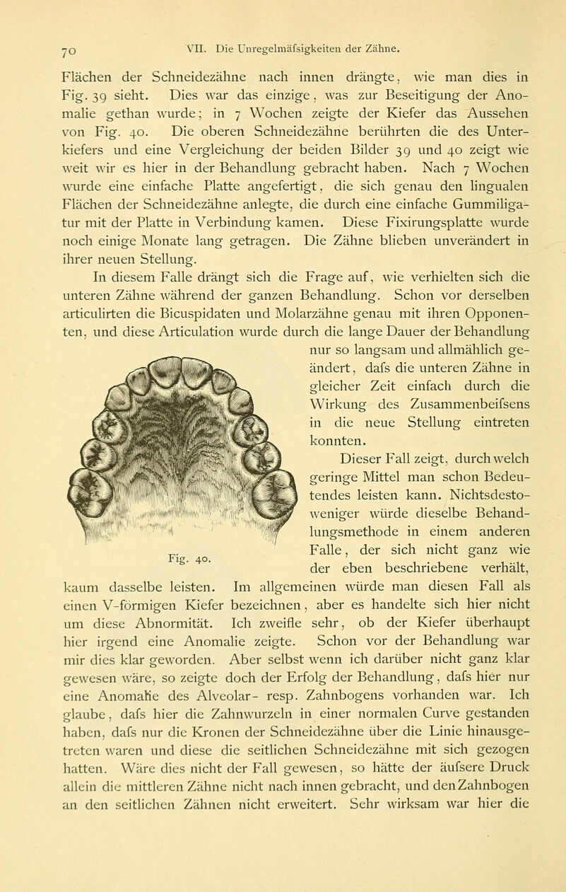 malie von Fig tur mit der Platte in Verbindung kamen noch einige Monate lang getragen Flächen der Schneidezähne nach innen drängte, wie man dies in Fig. 39 sieht. Dies war das einzige, was zur Beseitigung der Ano- han wurde; in 7 Wochen zeigte der Kiefer das Aussehen 40. Die oberen Schneidezähne berührten die des Unter- kiefers und eine Vergleichung der beiden Bilder 3 g und 40 zeigt wie weit wir es hier in der Behandlung gebracht haben. Nach 7 Wochen wurde eine einfache Platte angefertigt, die sich genau den lingualen Flächen der Schneidezähne anlegte, die durch eine einfache Gummiliga- Diese Fixirungsplatte wurde Die Zähne blieben unverändert in ihrer neuen Stellung. In diesem Falle drängt sich die Frage auf, wie verhielten sich die unteren Zähne während der ganzen Behandlung. Schon vor derselben articulirten die Bicuspidaten und Molarzähne genau mit ihren Opponen- ten, und diese Articulation wurde durch die lange Dauer der Behandlung nur so langsam und allmählich ge- ändert, dafs die unteren Zähne in gleicher Zeit einfach durch die Wirkung des Zusammenbeifsens in die neue Stellung eintreten konnten. Dieser Fall zeigt, durchweich geringe Mittel man schon Bedeu- tendes leisten kann. Nichtsdesto- weniger würde dieselbe Behand- lungsmethode in einem anderen Falle, der sich nicht ganz wie der eben beschriebene verhält, kaum dasselbe leisten. Im allgemeinen würde man diesen Fall als einen V-förmigen Kiefer bezeichnen, aber es handelte sich hier nicht um diese Abnormität. Ich zweifle sehr, ob der Kiefer überhaupt hier irgend eine Anomalie zeigte. Schon vor der Behandlung war mir dies klar geworden. Aber selbst wenn ich darüber nicht ganz klar gewesen wäre, so zeigte doch der Erfolg der Behandlung, dafs hier nur eine AnomaKe des Alveolar- resp. Zahnbogens vorhanden war. Ich glaube, dafs hier die Zahnwurzeln in einer normalen Curve gestanden haben, dafs nur die Kronen der Schneidezähne über die Linie hinausge- treten waren und diese die seitlichen Schneidezähne mit sich gezogen hatten. Wäre dies nicht der Fall gewesen, so hätte der äufsere Druck allein die mittleren Zähne nicht nach innen gebracht, und den Zahnbogen an den seitlichen Zähnen nicht erweitert. Sehr wirksam war hier die