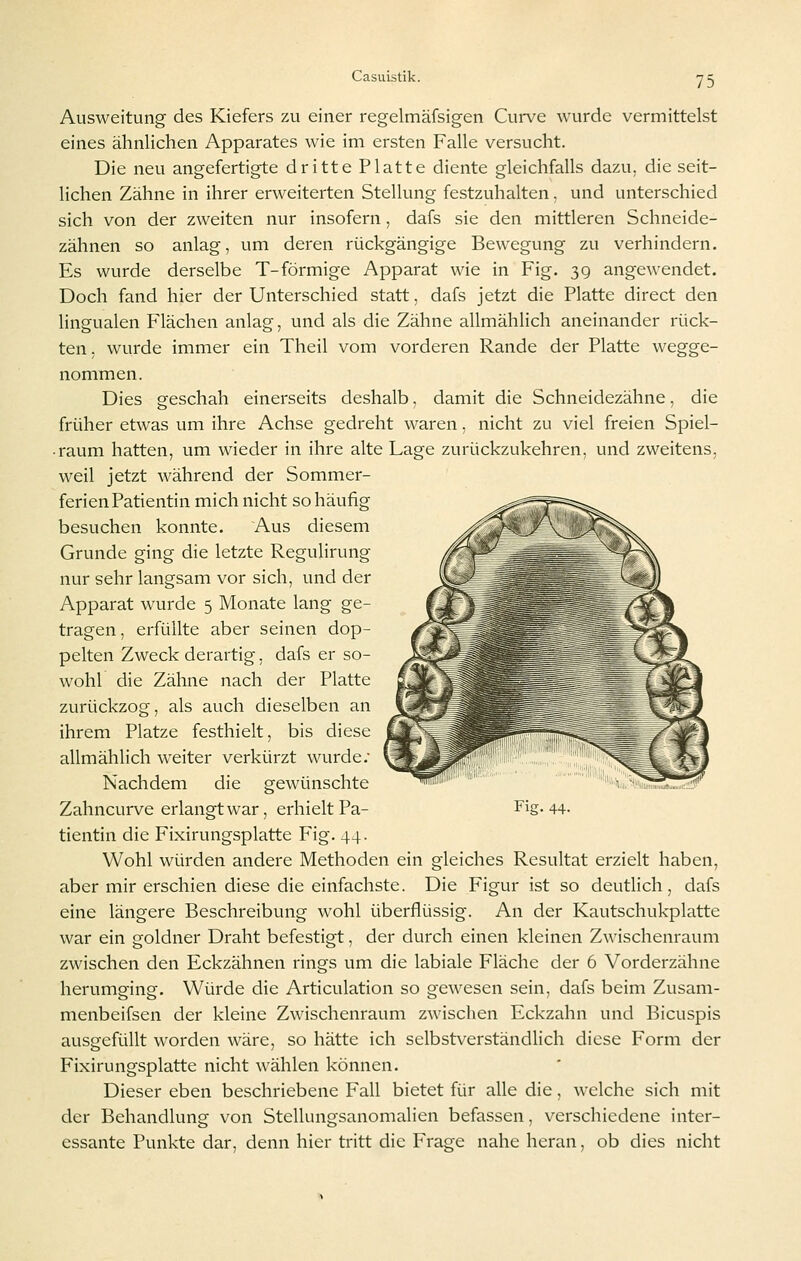 Ausweitung des Kiefers zu einer regelmäfsigen Curve wurde vermittelst eines ähnlichen Apparates wie im ersten Falle versucht. Die neu angefertigte dritte Platte diente gleichfalls dazu, die seit- lichen Zähne in ihrer erweiterten Stellung festzuhalten. und unterschied sich von der zweiten nur insofern, dafs sie den mittleren Schneide- zähnen so anlag, um deren rückgängige Bewegung zu verhindern. Es wurde derselbe T-förmige Apparat wie in Fig. 3g angewendet. Doch fand hier der Unterschied statt, dafs jetzt die Platte direct den lingualen Flächen anlag, und als die Zähne allmählich aneinander rück- ten . wurde immer ein Theil vom vorderen Rande der Platte wegge- nommen. Dies geschah einerseits deshalb, damit die Schneidezähne, die früher etwas um ihre Achse gedreht waren, nicht zu viel freien Spiel- • raum hatten, um wieder in ihre alte Lage zurückzukehren, und zweitens, weil jetzt während der Sommer- ferien Patientin mich nicht so häufig besuchen konnte. Aus diesem Grunde ging die letzte Regulirung nur sehr langsam vor sich, und der Apparat wurde 5 Monate lang ge- tragen , erfüllte aber seinen dop- pelten Zweck derartig, dafs er so- wohl die Zähne nach der Platte zurückzog, als auch dieselben an ihrem Platze festhielt, bis diese allmählich weiter verkürzt wurde; Nachdem die gewünschte tientin die Fixirungsplatte Fig. 44. Wohl würden andere Methoden ein gleiches Resultat erzielt haben, aber mir erschien diese die einfachste. Die Figur ist so deutlich, dafs eine längere Beschreibung wohl überflüssig. An der Kautschukplatte war ein goldner Draht befestigt, der durch einen kleinen Zwischenraum zwischen den Eckzähnen rings um die labiale Fläche der 6 Vorderzähne herumging. Würde die Articulation so gewesen sein, dafs beim Zusam- menbeifsen der kleine Zwischenraum zwischen Eckzahn und Bicuspis ausgefüllt worden wäre, so hätte ich selbstverständlich diese Form der Fixirungsplatte nicht wählen können. Dieser eben beschriebene Fall bietet für alle die, welche sich mit der Behandlung von Stellungsanomalien befassen, verschiedene inter- essante Punkte dar, denn hier tritt die Frage nahe heran, ob dies nicht
