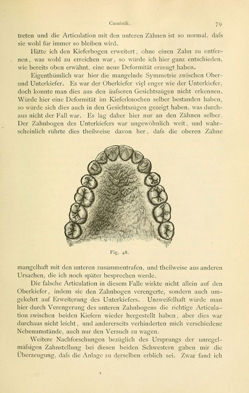 treten und die Articulation mit den unteren Zähnen ist so normal, dafs sie wohl für immer so bleiben wird. Hätte ich den Kieferbogen erweitert, ohne einen Zahn zu entfer- nen , was wohl zu erreichen war, so würde ich hier ganz entschieden, wie bereits oben erwähnt, eine neue Deformität erzeugt haben. Eigenthümlich war hier die mangelnde Symmetrie zwischen Ober- und Unterkiefer. Es war der Oberkiefer viel enger wie der Unterkiefer, doch konnte man dies aus den äufseren Gesichtszügen nicht erkennen. Würde hier eine Deformität im Kieferknochen selber bestanden haben, so würde sich dies auch in den Gesichtszügen gezeigt haben, was durch- aus nicht der Fall war. Es lag daher hier nur an den Zähnen selber. Der Zahnbogen des Unterkiefers war ungewöhnlich weit, und wahr- scheinlich rührte dies theilweise davon her. dafs die oberen Zähne Fig. 48. mangelhaft mit den unteren zusammentrafen, und theilweise aus anderen Ursachen, die ich nocli später besprechen werde. Die falsche Articulation in diesem Falle wirkte nicht allein auf den Oberkiefer, indem sie den Zahnbogen verengerte, sondern auch um- gekehrt auf Erweiterung des Unterkiefers. Unzweifelhaft würde man hier durch Verengerung des unteren Zahnbogens die richtige Articula- tion zwischen beiden Kiefern wieder hergestellt haben , aber dies war durchaus nicht leicht, und andererseits verhinderten mich verschiedene Nebenumstände, auch nur den Versuch zu wagen. Weitere Nachforschungen bezüglich des Ursprungs der unregel- mäfsigen Zahnstellung bei diesen beiden Schwestern gaben mir die Überzeugung, dafs die xA.nlage zu derselben erblich sei. Zwar fand ich