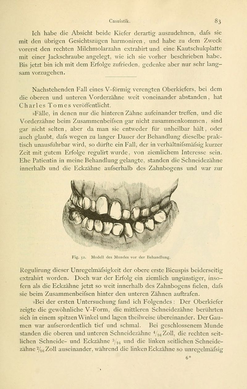 Ich habe die Absicht beide Kiefer derartig auszudehnen, dafs sie mit den übrigen Gesichtszügen harmoniren, und habe zu dem Zweck vorerst den rechten Milchmolarzahn extrahirt und eine Kautschukplatte mit einer Jackschraube angelegt, wie ich sie vorher beschrieben habe. Bis jetzt bin ich mit dem Erfolge zufrieden, gedenke aber nur sehr lang- sam vorzugehen. Nachstehenden Fall eines V-förmig verengten Oberkiefers, bei dem die oberen und unteren Vorderzähne weit voneinander abstanden. hat Charles Tomes veröffentlicht. »Fälle, in denen nur die hinteren Zähne aufeinander treffen, und die Vorderzähne beim Zusammenbeifsen gar nicht zusammenkommen, sind gar nicht selten, aber da man sie entweder für unheilbar hält, oder auch glaubt, dafs wegen zu langer Dauer der Behandlung dieselbe prak- tisch unausführbar wird, so dürfte ein Fall, der in verhältnifsmäfsig kurzer Zeit mit gutem Erfolge regulirt wurde. von ziemlichem Interesse sein. Ehe Patientin in meine Behandlung gelangte, standen die Schneidezähne innerhalb und die Eckzähne aufserhalb des Zahnboo'ens und war zur Fig. 52. Modell des iMuntles vor der Behandlung. ReguHrung dieser Unregelmäfsigkeit der obere erste Bicuspis beiderseitig extrahirt worden. Doch war der Erfolg ein ziemlich ungünstiger, inso- fern als die Eckzähne jetzt so weit innerhalb des Zahnbogens fielen, dafs sie beim Zusammenbeifsen hinter den unteren Zähnen auftrafen. »Bei der ersten Untersuchung fand ich Folgendes : Der Oberkiefer zeigte die gewöhnliche V-Form, die mittleren Schneidezähne berührten sich in einem spitzen Winkel und lagen theilweise übereinander. Der Gau- men war aufserordentlich tief und schmal. Bei geschlossenem Munde standen die oberen und unteren Schneidezähne Vi e Zoll, die rechten seit- lichen Schneide- und Eckzähne ''/n: '-•iid die linken seitlichen Schneide- zähne 2/,,; Zoll auseinander, während die linken Eckzähne so unregelmäfsig 6*