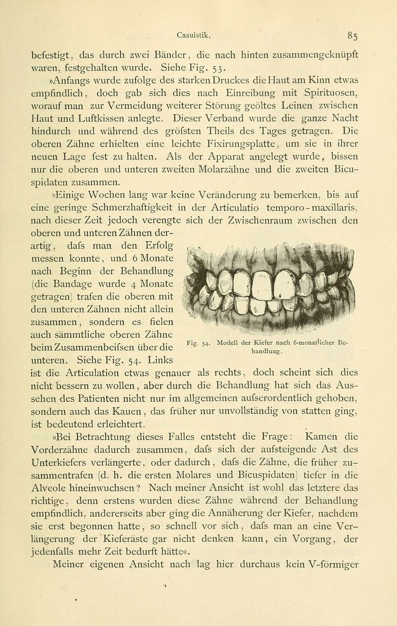 befestigt, das durch zwei Bänder, die nach hinten zusammengeknüpft waren, festgehalten wurde. Siehe Fig. 53. »Anfangs wurde zufolge des starken Druckes die Haut am Kinn etwas empfindlich, doch gab sich dies nach Einreibung mit Spirituosen, worauf man zur Vermeidung weiterer Störung geöltes Leinen zwischen Haut und Luftkissen anlegte. Dieser Verband wurde die ganze Nacht hindurch und während des gröfsten Theils des Tages getragen. Die oberen Zähne erhielten eine leichte Fixirungsplatte, um sie in ihrer neuen Lage fest zu halten. Als der Apparat angelegt wurde, bissen nur die oberen und unteren zweiten Molarzähne und die zweiten Bicu- spidaten zusammen. »Einige Wochen lang war keine Veränderung zu bemerken, bis auf eine geringe Schmerzhaftigkeit in der Articulatio temporo-maxillaris. nach dieser Zeit jedoch verengte sich der Zwischenraum zwischen den oberen und unteren Zähnen der- artig, dafs man den Erfolg messen konnte, und 6 Monate nach Beginn der Behandlung (die Bandage wurde 4 Monate getragen) trafen die oberen mit den unteren Zähnen nicht allein zusammen, sondern es fielen auch sämmtliche oberen Zähne t . F-r IT --i T tie ';4 Modell der Kiefer nach 6-monatlicher Be- beim Zusammenbeilsen über die handiun?. unteren. Siehe Fig. 54. Links ist die Articulation etwas genauer als rechts, doch scheint sich dies nicht bessern zu wollen, aber durch die Behandlung hat sich das Aus- sehen des Patienten nicht nur im allgemeinen aufserordentlich gehoben, sondern auch das Kauen, das früher nur unvollständig von statten ging, ist bedeutend erleichtert. »Bei Betrachtung dieses Falles entsteht die Frage: Kamen die Vorderzähne dadurch zusammen, dafs sich der aufsteigende Ast des Unterkiefers verlängerte, oder dadurch , dafs die Zähne, die früher zu- sammentrafen (d. h. die ersten Molares und Bicuspidaten) tiefer in die Alveole hineinwuchsen? Nach meiner Ansicht ist wohl das letztere das richtige, denn erstens wurden diese Zähne während der Behandlung empfindlich, andererseits aber ging die Annäherung der Kiefer, nachdem sie erst begonnen hatte, so schnell vor sich, dafs man an eine Ver- längerung der Kieferäste gar nicht denken kann, ein Vorgang, der jedenfalls mehr Zeit bedurft hätte«. Meiner eigenen Ansicht nach lag hier durchaus kein V-förmiger