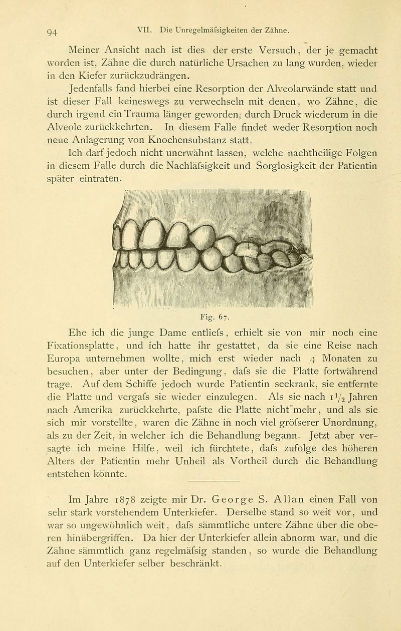 Meiner Ansicht nach ist dies der erste Versuch , der je gemacht worden ist, Zähne die durch natürhche Ursachen zu lang wurden, wiedei' in den Kiefer zurückzudrängen. Jedenfalls fand hierbei eine Resorption der Alveolarwände statt und ist dieser Fall keineswegs zu verwechseln mit denen, wo Zähne, die durch irgend ein Trauma länger geworden.; durch Druck wiederum in die Alveole zurückkehrten. In diesem Falle findet weder Resorption noch neue Anlagerung von Knochensubstanz statt. Ich darf jedoch nicht unerwähnt lassen, welche nachtheiUge Folgen in diesem Falle durch die Nachläfsigkeit und Sorglosigkeit der Patientin später eintraten. Fig. 67. Ehe ich die junge Dame entliefs, erhielt sie von mir noch eine Fixationsplatte, und ich hatte ihr gestattet, da sie eine Reise nach Europa unternehmen wollte, mich erst wieder nach 4 Monaten zu besuchen. aber unter der Bedingung. dafs sie die Platte fortwährend trage. Auf dem Schiffe jedoch wurde Patientin seekrank, sie entfernte die Platte und vergafs .sie wieder einzulegen. Als sie nach 11/2 Jahren nach Amerika zurückkehrte, pafste die Platte nicht'mehr, und als sie sich mir vorstellte, waren die Zähne in noch viel gröfserer Unordnung, als zu der Zeit, in welcher ich die Behandlung begann. Jetzt aber ver- sagte ich meine Hilfe, weil ich fürchtete, dafs zufolge des höheren Alters der Patientin mehr Unheil als Vortheil durch die Behandlung entstehen könnte. Im Jahre 1878 zeigte mir Dr. George S. Allan einen Fall von sehr stark vorstehendem Unterkiefer. Derselbe .stand so weit vor, und war so ungewöhnlich weit, dafs sämmtliche untere Zähne über die obe- ren hinübergriffen. Da hier der Unterkiefer allein abnorm war, und die Zähne sämmtlich ganz regelmäfsig .standen, .so wurde die Behandlung auf den Unterkiefer selber beschränkt.