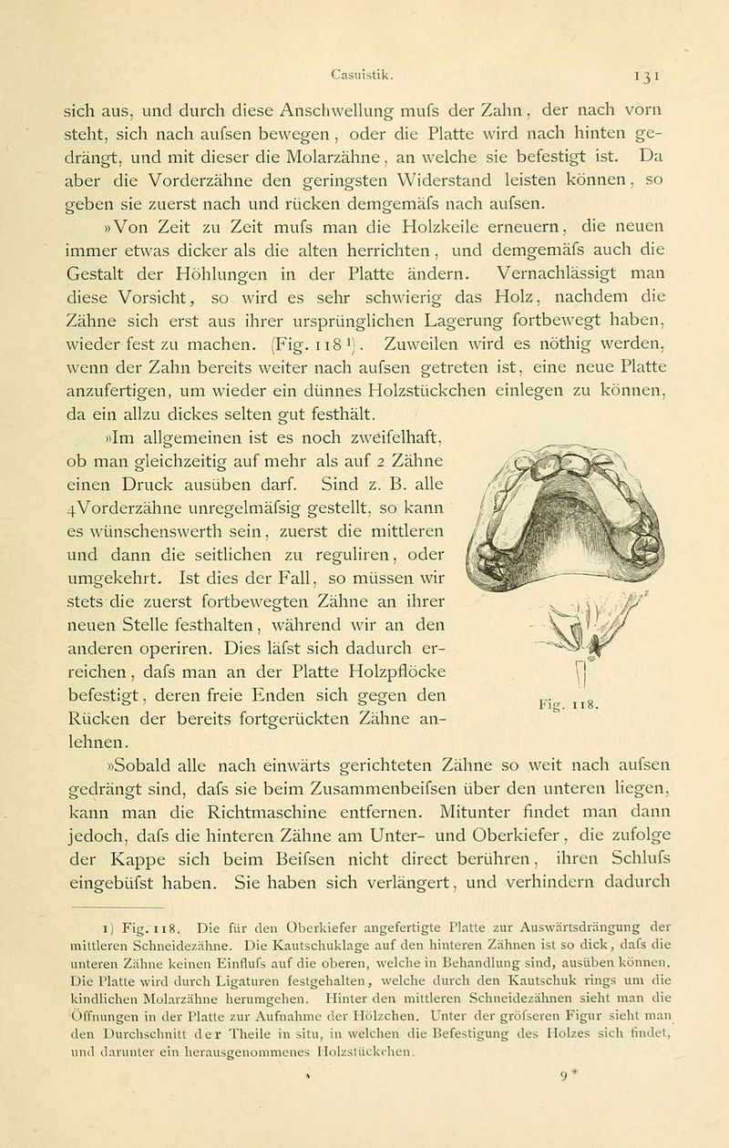 sich aus, und durch diese AnschweUung mufs der Zahn, der nach vorn steht, sich nach aufsen bewegen, oder die Platte wird nach hinten ge- drängt, und mit dieser die Molarzähne, an welche sie befestigt ist. Da aber die Vorderzähne den geringsten Widerstand leisten können, so geben sie zuerst nach und rücken demgemäfs nach aufsen. »Von Zeit zu Zeit mufs man die Holzkeile erneuern, die neuen immer etwas dicker als die alten herrichten, und demgemäfs auch die Gestalt der Höhlungen in der Platte ändern. Vernachlässigt man diese Vorsicht, so wird es sehr schwierig das Holz, nachdem die Zähne sich erst aus ihrer ursprünglichen Lagerung fortbewegt haben, wieder fest zu machen. (Fig. iiS^). Zuweilen wird es nöthig werden, wenn der Zahn bereits weiter nach aufsen getreten ist, eine neue Platte anzufertigen, um wieder ein dünnes Holzstückchen einlegen zu können, da ein allzu dickes selten gut festhält. »Im allgemeinen ist es noch zweifelhaft, ob man gleichzeitig auf mehr als auf 2 Zähne einen Druck ausüben darf. Sind z. B. alle 4Vorderzähne unregelmäfsig gestellt, so kann es wünschenswert!! sein, zuerst die mittleren und dann die seitlichen zu reguliren, oder umgekehrt. Ist dies der Fall, so müssen wir stets die zuerst fortbewegten Zähne an ihrer neuen Stelle festhalten, während wir an den anderen operiren. Dies läfst sich dadurch er- reichen , dafs man an der Platte Holzpflöcke befestigt, deren freie Enden sich gegen den Rücken der bereits fortgerückten Zähne an- lehnen. «Sobald alle nach einwärts gerichteten Zähne so weit nach aufsen gedrängt sind, dafs sie beim Zusammenbeifsen über den unteren liegen, kann man die Richtmaschine entfernen. Mitunter findet man dann jedoch, dafs die hinteren Zähne am Unter- und Oberkiefer, die zufolge der Kappe sich beim Beifsen nicht direct berühren, ihren Schlufs eingebüfst haben. Sie haben sich verlängert, und verhindern dadurch Fig. 118. i) Fig. 118. Die für den Überkiefer angefertigte Platte zur Auswärtsdrängung der mittleren Schneidezähne. Die Kautschuklage auf den hinteren Zähnen ist so dick, dafs die unteren Zähne keinen Einflufs auf die oberen, welche in Behandlung sind, ausüben können. Die Platte wird durch Ligaturen festgehalten, welche durch den Kautschuk rings um die kindlichen Molarzähne herumgehen. Hinter den mittleren Schneidezähnen sieht man die Öffnungen in der Platte zur Aufnahme der Hölzchen. Unter der gröfseren Figur sieht man den Durchschnitt der Theile in situ, in welchen die Befestigung des Holzes sich findet, und darunter ein herausgenommenes Holzslückclien,