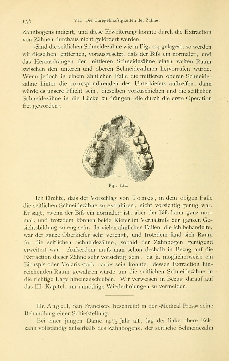 Zahnbogens indicirt, und diese Erweiterung konnte durch die Extraction von Zähnen durchaus nicht gefördert werden. »Sind die seitHchen Schneidezähne wie in Fig. 124 gelagert, so werden wir dieselben entfernen, vorausgesetzt, dafs der Bifs ein normaler, und das Herausdrängen der mittleren Schneidezähne einen weiten Raum zwischen den unteren und oberen Schneidezähnen hervorrufen würde. Wenn jedoch in einem ähnlichen Falle die mittleren oberen Schneide- zähne hinter die correspondirenden des Unterkiefers auftreffen, dann würde es unsere Pflicht sein, dieselben vorzuschieben und die seitlichen Schneidezähne in die Lücke zu drängen, die durch die erste Operation frei gfeworden«. Fig. 124. Ich fürchte, dafs der Vorschlag von Tom es, in dem obigen Falle die seitlichen Schneidezähne zu extrahiren, nicht vorsichtig genug war. Er sagt, »wenn der Bifs ein normaler« ist, aber der Bifs kann ganz nor- mal , und trotzdem können beide Kiefer im Verhältnifs zur ganzen Ge- sichtsbildung zu eng sein. In vielen ähnlichen Fällen, die ich behandelte, war der ganze Oberkiefer sehr verengt, und trotzdem fand sich Raurri für die seitlichen Schneidezähne, sobald der Zahnbogen genügend erweitert war. Aufserdem mufs man schon deshalb in Bezug auf die Extraction dieser Zähne sehr vorsichtig sein, da ja möglicherweise ein Bicuspis oder Molaris stark cariös sein könnte, dessen Extraction hin- reichenden Raum gewähren würde um die seitlichen Schneidezähne in die richtige Lage hineinzuschieben. Wir verweisen in Bezug darauf auf das III. Kapitel, um unnöthige Wiederholungen zu vermeiden. Dr. Angell, San Francisco, beschreibt in der »Medical Press« seine Behandlung einer Schiefstellung. Bei einer jungen Dame 14^2 Jahr alt, lag der linke obere Eck- zahn vollständig aufserhalb des Zahnbogens, der seitliche Schneidezahn
