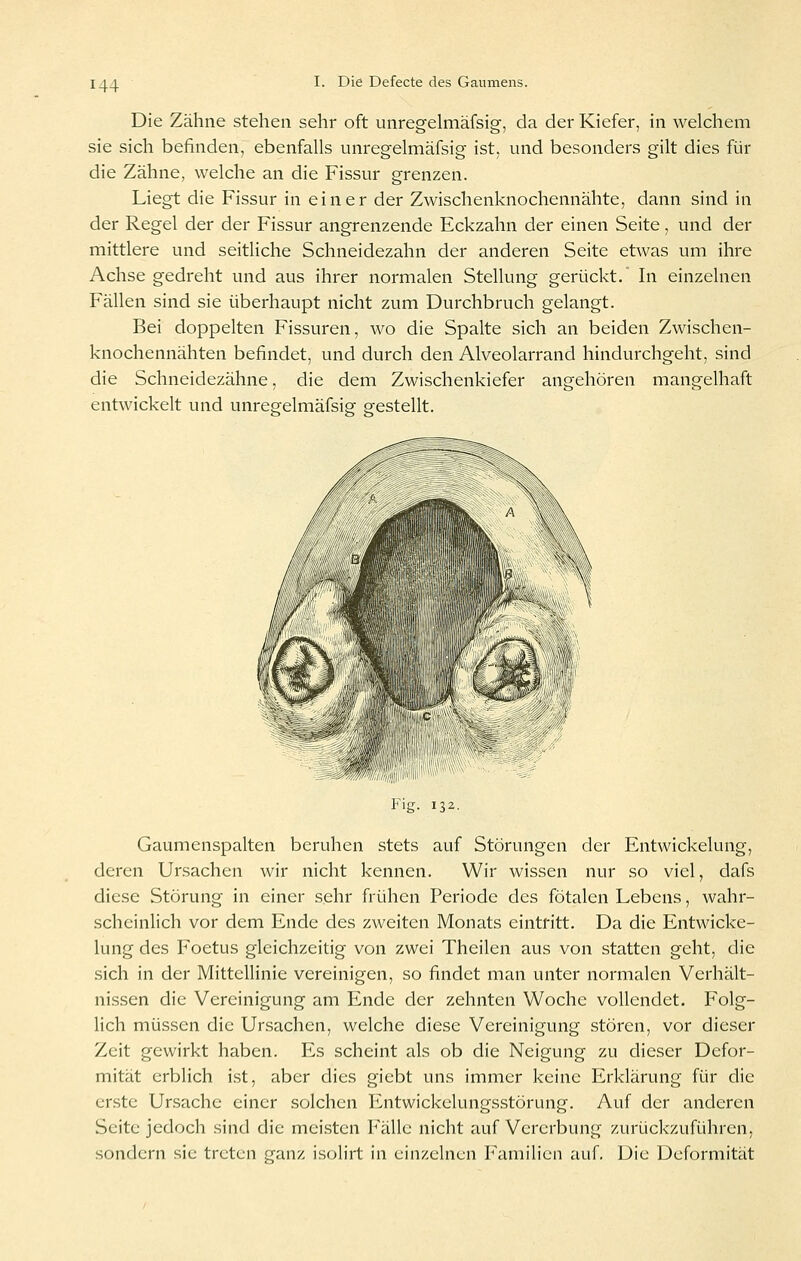 Die Zähne stehen sehr oft unregelmäfsig, da der Kiefer, in welchem sie sich befinden, ebenfalls unregelmäfsig ist, und besonders gilt dies für die Zähne, welche an die Fissur grenzen. Liegt die Fissur in einer der Zwischenknochennähte, dann sind in der Regel der der Fissur angrenzende Eckzahn der einen Seite, und der mittlere und seitliche Schneidezahn der anderen Seite etwas um ihre Achse gedreht und aus ihrer normalen Stellung gerückt. In einzelnen Fällen sind sie überhaupt nicht zum Durchbruch gelangt. Bei doppelten Fissuren, wo die Spalte sich an beiden Zwischen- knochennähten befindet, und durch den Alveolarrand hindurchgeht, sind die Schneidezähne, die dem Zwischenkiefer angehören mangelhaft entwickelt und unregelmäfsig gestellt. Fig. 132. Gaumenspalten beruhen stets auf Störungen der Entwickelung, deren Ursachen wir nicht kennen. Wir wissen nur so viel, dafs diese Störung in einer sehr frühen Periode des fötalen Lebens, wahr- scheinlich vor dem Ende des zweiten Monats eintritt. Da die Entwicke- lung des Foetus gleichzeitig von zwei Theilen aus von statten geht, die .sich in der Mittellinie vereinigen, so findet man unter normalen Verhält- nissen die Vereinigung am Ende der zehnten Woche vollendet. Folg- lich müssen die Ursachen, welche diese Vereinigung stören, vor dieser Zeit gewirkt haben. Es scheint als ob die Neigung zu dieser Defor- mität erblich ist, aber dies giebt uns immer keine Erklärung für die er.ste Ursache einer solchen Entwickelungsstörung. Auf der anderen Seite jedoch sind die meüsten Fälle nicht auf Vererbung zurückzuführen, sondern sie treten ganz isolirt in einzelnen Familien auf. Die Deformität