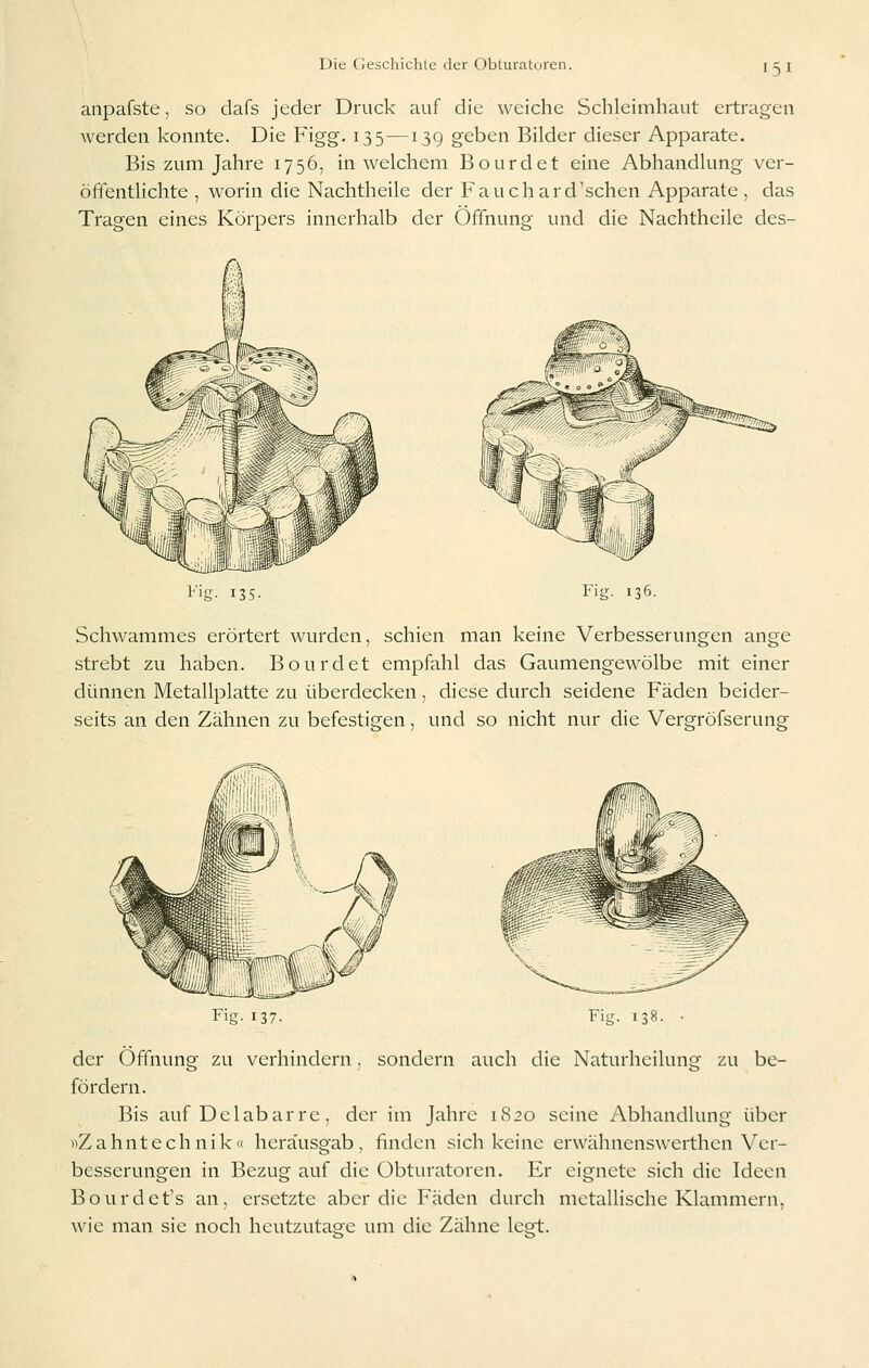 anpafste, so dafs jeder Druck auf die weiche Schleimhaut ertragen werden konnte. Die Figg. 135 —139 geben Bilder dieser Apparate. Bis zum Jahre 1756, in welchem Bourdet eine Abhandlung ver- öffentlichte , worin die Nachtheile der Fauchard'schen Apparate , das Tragen eines Körpers innerhalb der Öffnung und die Nachtheile des- t'ig- 135- Fig. 136. Schwammes erörtert wurden, schien man keine Verbesserungen ange strebt zu haben. Bourdet empfahl das Gaumengewölbe mit einer dünnen Metallplatte zu überdecken, diese durch seidene Fäden beider- seits an den Zähnen zu befestigen, und so nicht nur die Vergröfserung Fig 137 Fig. 138. der Öffnung zu verhindern. sondern auch die Naturheilung zu be- fördern. Bis auf Dclabarrc, der im Jahre 1820 seine Abhandlung über »Zahntechnik« herausgab, finden sich keine erwähnenswerthen Ver- besserungen in Bezug auf die Obturatoren. Er eignete sich die Ideen Bourdet's an, ersetzte aber die Fäden durch metallische Klammern, wie man sie noch heutzutage um die Zähne legt.