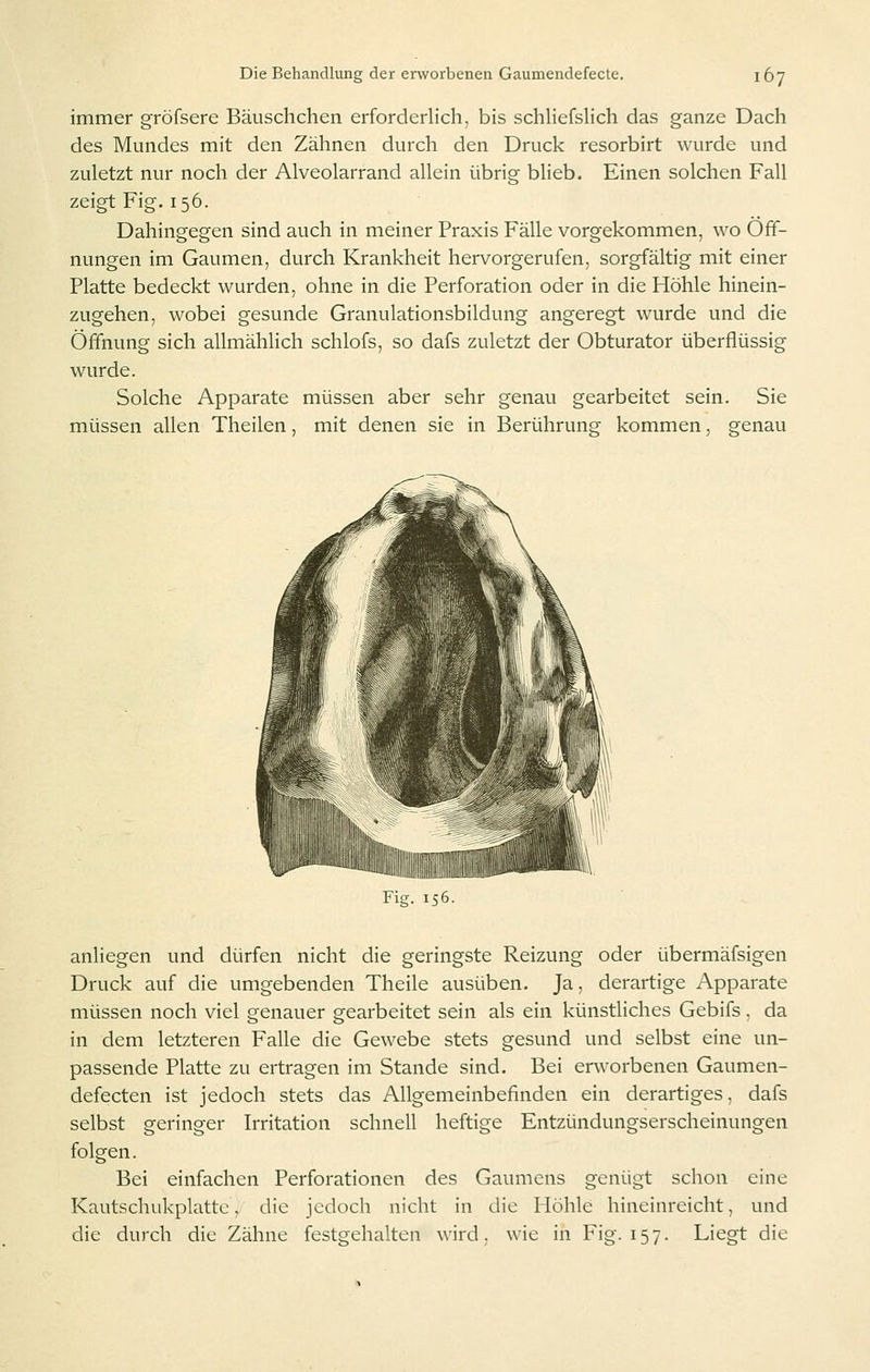immer gröfsere Bäuschchen erforderhch, bis schhefsHch das ganze Dach des Mundes mit den Zähnen durch den Druck resorbirt wurde und zuletzt nur noch der Alveolarrand allein übrig blieb. Einen solchen Fall zeigt Fig. 156. Dahingegen sind auch in meiner Praxis Fälle vorgekommen, wo Off- nungen im Gaumen, durch Krankheit hervorgerufen, sorgfältig mit einer Platte bedeckt wurden, ohne in die Perforation oder in die Höhle hinein- zugehen, wobei gesunde Granulationsbildung angeregt wurde und die Öffnung sich allmählich schlofs, so dafs zuletzt der Obturator überflüssig wurde. Solche Apparate müssen aber sehr genau gearbeitet sein. Sie müssen allen Theilen, mit denen sie in Berührung kommen, genau anliegen und dürfen nicht die geringste Reizung oder übermäfsigen Druck auf die umgebenden Theile ausüben. Ja, derartige Apparate müssen noch viel genauer gearbeitet sein als ein künstliches Gebifs, da in dem letzteren Falle die Gewebe stets gesund und selbst eine un- passende Platte zu ertragen im Stande sind. Bei erworbenen Gaumen- defecten ist jedoch stets das Allgemeinbefinden ein derartiges, dafs selbst geringer Irritation schnell heftige Entzündungserscheinungen folgen. Bei einfachen Perforationen des Gaumens genügt schon eine Kautschukplattc, die jedoch nicht in die Höhle hineinreicht, und die durch die Zähne festgehalten wird, wie in Fig. 157. Liegt die