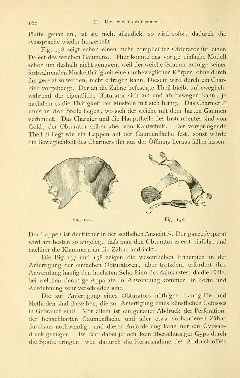 Platte genau an, ist sie nicht allzudick, so wird sofort dadurch die Aussprache wieder hergestellt. Fig. 158 zeigt schon einen mehr complicirten Obturator für einen Defect des weichen Gaumens. Hier konnte das vorige einfache Modell schon um deshalb nicht genügen, weil der weiche Gaumen zufolge seiner fortwährenden Muskelthätigkeit einen unbeweghchen Körper, ohne durch ihn gereizt zu werden, nicht ertragen kann. Diesem wird durch ein Char- nier vorgebeugt. Der an die Zähne befestigte Theil bleibt unbeweglich, während der eigentliche Obturator sich auf und ab bewegen kann , je nachdem es die Thätigkeit der Muskeln mit sich bringt. Das Charniery4 mufs an d e r Stelle liegen, wo sich der weiche mit dem harten Gaumen verbindet. Das Charnier und die Haupttheile des Instrumentes sind von Gold, der Obturator selber aber von Kautschuk. Der vorspringende Theil B liegt wie ein Lappen auf der Gaumenfläche fest, sonst würde die Beweglichkeit des Charniers ihn aus der Öffnung heraus fallen lassen. Fig. 157- Fig. 158. Der Lappen ist deutlicher in der seitlichen Ansicht j5. Der ganze Apparat wird am besten so angelegt, dafs man den Obturator zuerst einführt und nachher die Klammern an die Zähne andrückt. Die Fig. 157 und 158 zeigen die wesentlichen Principien in der Anfertigung der einfachen Obturatoren, aber trotzdem erfordert ihre Anwendung häufig den höchsten Scharfsinn des Zahnarztes, da die Fälle, bei welchen derartige Apparate in Anwendung kommen, in Form und Ausdehnung sehr verschieden sind. Die zur Anfertigung eines Obturators nöthigen Handgriffe und Methoden sind dieselben, die zur Anfertigung eines künstlichen Gebisses in Gebrauch sind. Vor allem ist ein genauer Abdruck der Perforation, der benachbarten Gaumenfläche und aller etwa vorhandenen Zähne durchaus nothwendig, und dieser Anforderung kann nur ein Gypsab- druck genügen. Es darf dabei jedoch kein überschü.ssiger Gyps durch die Spalte dringen, weil dadurch die Herausnahme des Abdrucklöffels