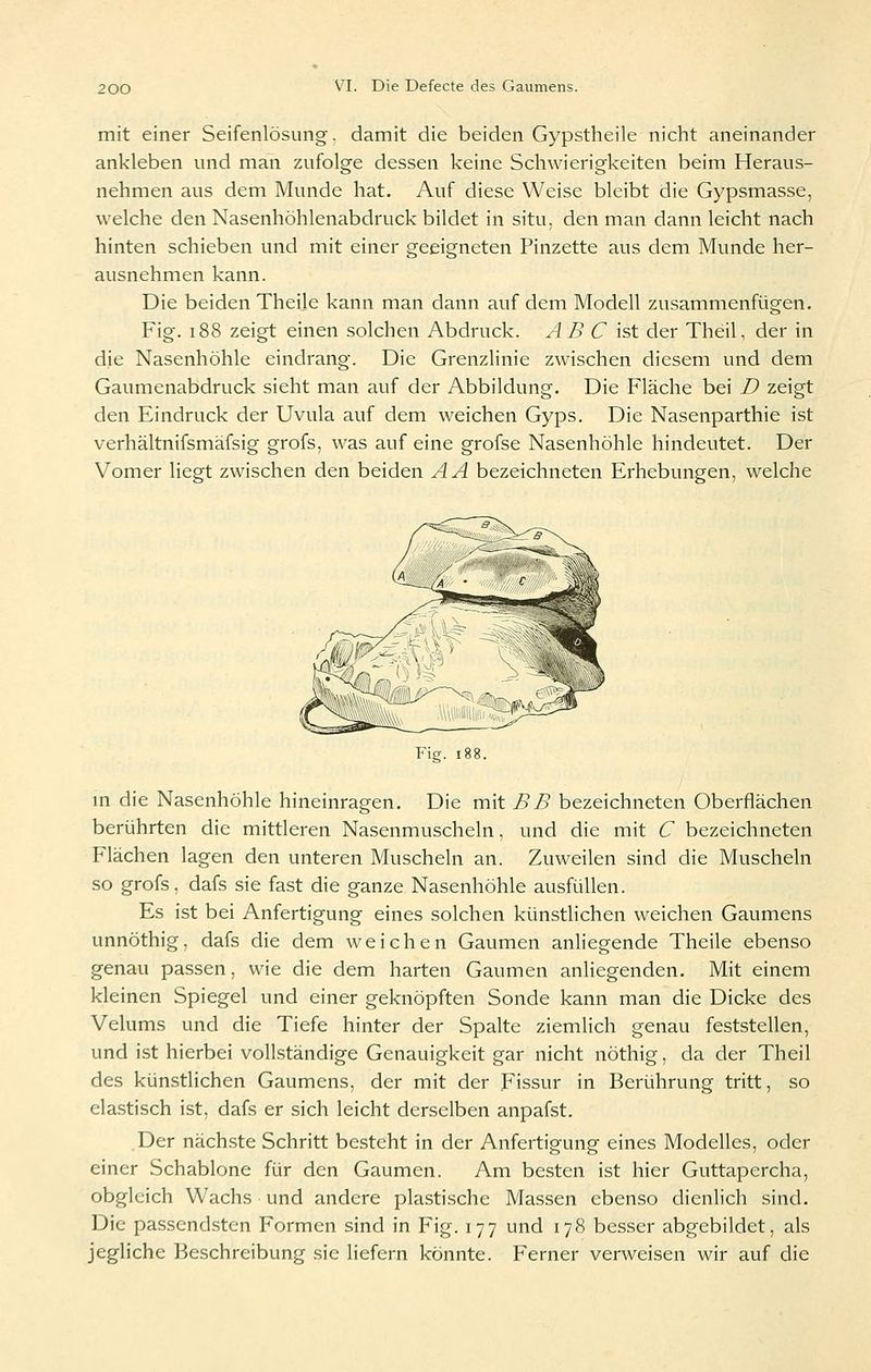 mit einer Seifenlösung, damit die beiden Gypstheile nicht aneinander ankleben und man zufolge dessen keine Schwierigkeiten beim Heraus- nehmen aus dem Munde hat. Auf diese Weise bleibt die Gypsmasse, welche den Nasenhöhlenabdruck bildet in situ, den man dann leicht nach hinten schieben und mit einer geeigneten Pinzette aus dem Munde her- ausnehmen kann. Die beiden Theile kann man dann auf dem Modell zusammenfügen. Fig. i88 zeigt einen solchen Abdruck. ABC ist der Theil, der in die Nasenhöhle eindrang. Die Grenzlinie zwischen diesem und dem Gaumenabdruck sieht man auf der Abbildung. Die Fläche bei D zeigt den Eindruck der Uvula auf dem weichen Gyps. Die Nasenparthie ist verhältnifsmäfsig grofs, was auf eine grofse Nasenhöhle hindeutet. Der Vomer liegt zwischen den beiden AA bezeichneten Erhebungen, welche Fig. i88. m die Nasenhöhle hineinragen. Die mit BB bezeichneten Oberflächen berührten die mittleren Nasenmuscheln, und die mit C bezeichneten Flächen lagen den unteren Muscheln an. Zuweilen sind die Muscheln so grofs, dafs sie fast die ganze Nasenhöhle ausfüllen. Es ist bei Anfertigung eines solchen künstlichen weichen Gaumens unnöthig, dafs die dem weichen Gaumen anliegende Theile ebenso genau passen, wie die dem harten Gaumen anliegenden. Mit einem kleinen Spiegel und einer geknöpften Sonde kann man die Dicke des Velums und die Tiefe hinter der Spalte ziemlich genau feststellen, und ist hierbei vollständige Genauigkeit gar nicht nöthig, da der Theil des künstlichen Gaumens, der mit der Fissur in Berührung tritt, so ela.stisch ist, dafs er sich leicht derselben anpafst. Der näch-ste Schritt besteht in der Anfertigung eines Modelies, oder einer Schablone für den Gaumen. Am besten i.st hier Guttapercha, obgleich Wachs und andere plastische Massen ebenso dienlich sind. Die passendsten Formen sind in Fig. 177 und 178 besser abgebildet, als jegliche Beschreibung sie Hefern könnte. Ferner verweisen wir auf die