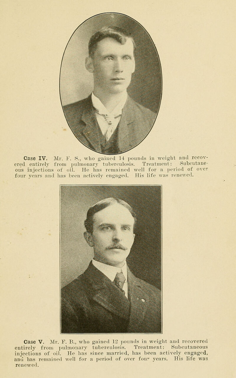 Case IV. Mr. Y. S., who gained 14 pounds in weight and recov- ered entirely from puhnonary tuberculosis. Treatment: Subcutane- ous injections of oil. He has remained well for a period of over four years and has been actively engaged.. His life was rencATed. Case V. Mr. F. B., who gained 12 pounds in weight and recovered entirely from pulmonary tuberculosis. Treatment: Subcutaneous injections of oil. He has since married, has been actively engaged, and has remained Avell for a period of over four years. His life was renewed.