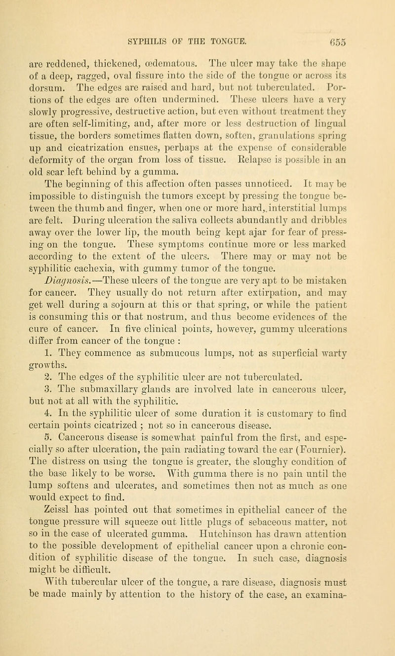 SYPHILIS OF THE TONGUE. f555 tire reddened, thickened, codematous. The ulcer may take the shape of a deep, ragged, oval fissure into the side of the tongue or across its dorsum. The edges are raised and hard, but not tuberculated. Por- tions of the edges are often undermined. These ulcers have a very slowly progressive, destructive action, but even without treatment they are often self-limiting, and, after more or less destruction of lingual tissue, the borders sometimes flatten down, soften, granulations spring up and cicatrization ensues, perhaps at the expense of considerable deformity of the organ from loss of tissue. Eelapse is possible in an old scar left behind by a gumma. The beginning of this affection often passes unnoticed. It may be impossible to distinguish the tumors except by pressing the tongue be- tween the thumb and finger, when one or more hard,,interstitial lumps are felt. During ulceration the saliva collects abundantly and dribbles away over the lower lip, the mouth being kept ajar for fear of press- ing on the tongue. These symptoms continue more or less marked according to the extent of the ulcers. There may or may not be syphilitic cachexia, with gummy tumor of the tongue. Diagiiosis.—These ulcers of the tongue are very apt to be mistaken for cancer. They usually do not return after extirpation, and may get well during a sojourn at this or that sjDring, or while the jDatient is consuming this or that nostrum, and thus become evidences of the cure of cancer. In five clinical points, however, gummy ulcerations differ from cancer of the tongue : 1. They commence as submucous lumps, not as superficial warty growths. 2. The edges of the syphilitic ulcer are not tuberculated. 3. The submaxillary glands are involved late in cancerous ulcer, but not at all with the syphilitic. 4. In the syphilitic ulcer of some duration it is customary to find certain points cicatrized ; not so in cancerous disease. 5. Cancerous disease is somewhat painful from the first, and espe- cially so after ulceration, the pain radiating toward the ear (Fournier). The distress on using the tongue is greater, the sloughy condition of the base likely to be worse. With gumma there is no pain until the lump softens and ulcerates, and sometimes then not as much as one would expect to find. Zeissl has pointed out that sometimes in epithelial cancer of the tongue pressure will squeeze out little plugs of sebaceous matter, not so in the case of ulcerated gumma. Hutchinson has drawn attention to the possible development of epithelial cancer upon a chronic con- dition of syphilitic disease of the tongue. In such case, diagnosis might be difficult. With tubercular ulcer of the tongue, a rare disease, diagnosis must be made mainly by attention to the history of the case, an examina-