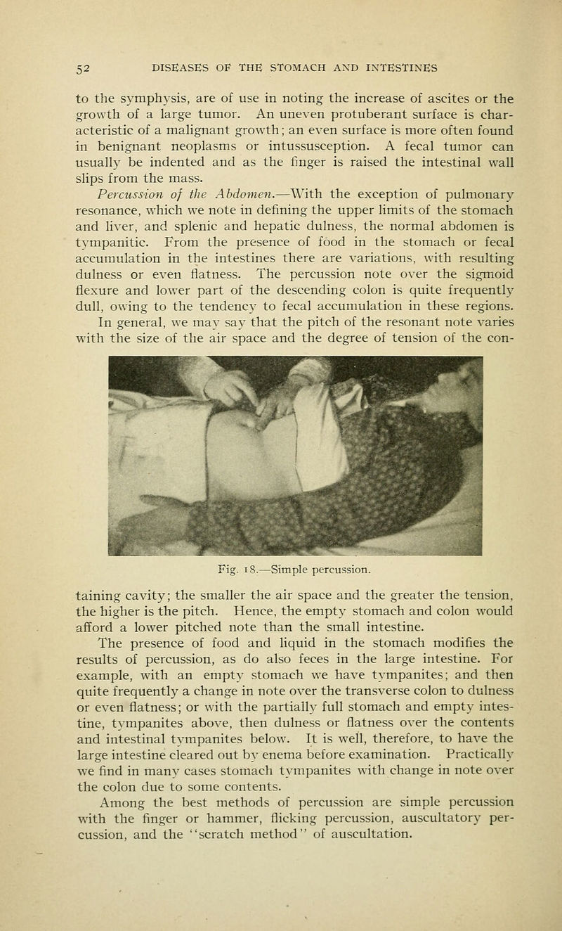 to the symphysis, are of use in noting the increase of ascites or the growth of a large tumor. An uneven protuberant surface is char- acteristic of a malignant growth; an even surface is more often found in benignant neoplasms or intussusception. A fecal tumor can usually be indented and as the finger is raised the intestinal wall slips from the mass. Percussion of the Abdomen.—With the exception of pulmonary resonance, which we note in defining the upper limits of the stomach and liver, and splenic and hepatic dulness, the normal abdomen is tvmpanitic. From the presence of food in the stomach or fecal accumulation in the intestines there are variations, with resulting dulness or even flatness. The percussion note over the sigmoid flexure and lower part of the descending colon is quite frequently dull, owing to the tendency to fecal accunmlation in these regions. In general, we mav say that the pitch of the resonant note varies w'ith the size of the air space and the degree of tension of the con- Simple percussion. taining cavity; the smaller the air space and the greater the tension, the higher is the pitch. Hence, the empty stomach and colon would afford a lower pitched note than the small intestine. The presence of food and liquid in the stomach modifies the results of percussion, as do also feces in the large intestine. For example, with an empty stomach we have tympanites; and then quite frequently a change in note over the transverse colon to dulness or even flatness; or with the partially full stomach and empty intes- tine, tympanites above, then dulness or flatness over the contents and intestinal tvmpanites below. It is well, therefore, to have the large intestine cleared out by enema before examination. Practically we find in many cases stomach tympanites with change in note over the colon due to some contents. Among the best methods of percussion are simple percussion with the finger or hammer, flicking percussion, auscultatory per- cussion, and the scratch method of auscultation.