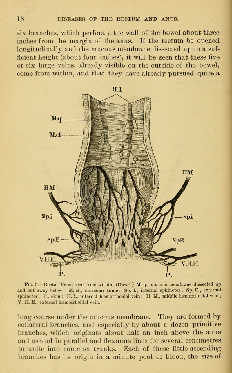 six branches, which perforate the wall of the bowel about three inches from the margin of the aims. If the rectum be opened longitudinally and the mucous membrane dissected up to a suf- ficient height (about four inches), it will be seen that these five or six large veins, already visible on the outside of the bowel, come from within, and that they have already pursued quite a H.I Fio. 5.—Rectal Veins seen from within. (Duret.) M. q., mucous membrane dissected up and cut away below; M. cl., muscular tunic; Sp. I, internal sphincter; Sp. E., external sphincter; P., skin ; H. I., internal haemorrhoidal vein ; H. M., middle haemorrhoidal vein ; V. H. E., external hemorrhoidal vein. long course under the mucous membrane. They are formed by collateral branches, and especially by about a dozen primitive branches, which originate about half an inch above the anus and ascend in parallel and flexuous lines for several centimetres to unite into common trunks. Each of these little ascending branches has its origin in a minute pool of blood, the size of