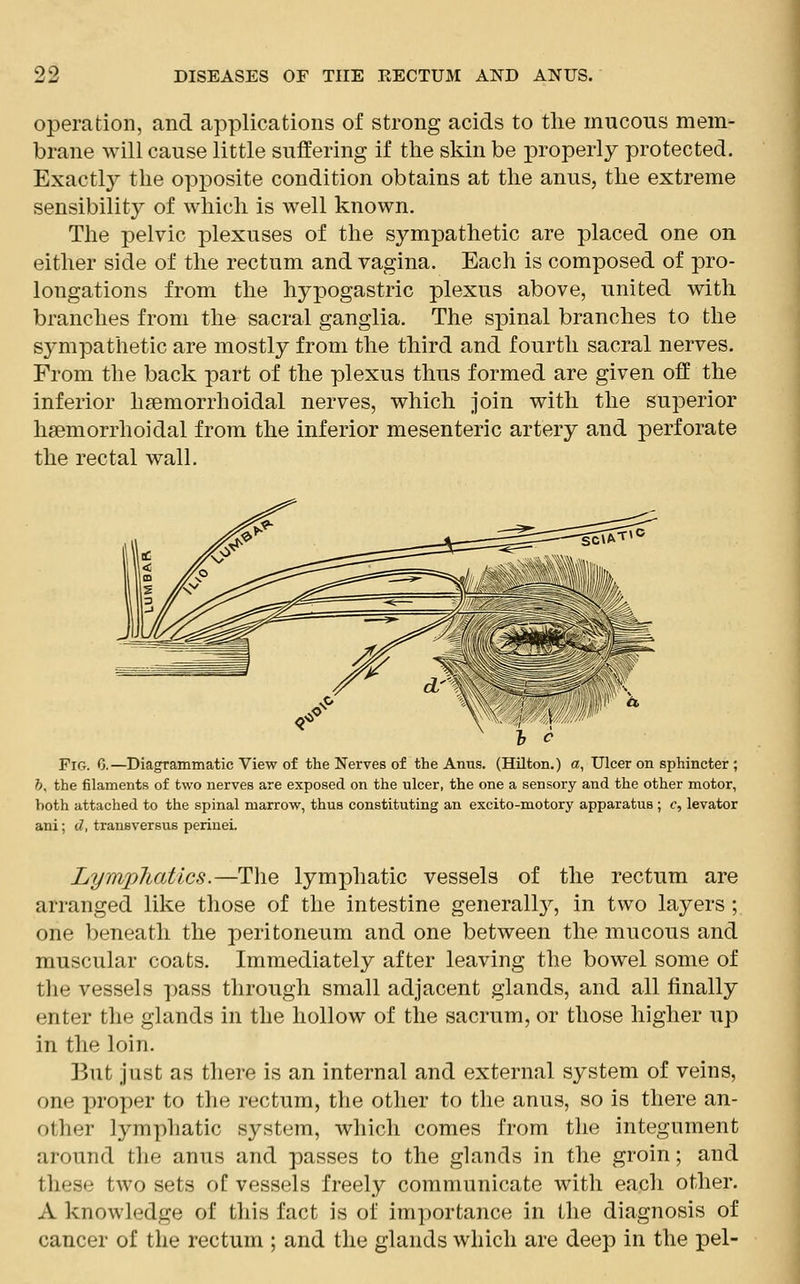 operation, and applications of strong acids to the mucous mem- brane will cause little suffering if the skin be properly protected. Exactly the opposite condition obtains at the anus, the extreme sensibility of which is well known. The pelvic plexuses of the sympathetic are placed one on either side of the rectum and vagina. Each is composed of pro- longations from the hypogastric plexus above, united with branches from the sacral ganglia. The spinal branches to the sj^mpathetic are mostly from the third and fourth sacral nerves. From the back part of the plexus thus formed are given off the inferior hemorrhoidal nerves, which join with the superior hemorrhoidal from the inferior mesenteric artery and perforate the rectal wall. Fig. C.—Diagrammatic View of the Nerves of the Anus. (Hilton.) a, Ulcer on sphincter ; b, the filaments of two nerves are exposed on the ulcer, the one a sensory and the other motor, both attached to the spinal marrow, thus constituting an excito-motory apparatus ; c, levator ani; c7, transversus perinei. Lymphatics.—The lymphatic vessels of the rectum are arranged like those of the intestine generally, in two layers; one beneath the peritoneum and one between the mucous and muscular coats. Immediately after leaving the bowel some of the vessels pass through small adjacent glands, and all finally enter the glands in the hollow of the sacrum, or those higher up in the loin. But just as there is an internal and external system of veins, one proper to the rectum, the other to the anus, so is there an- other lymphatic system, which conies from the integument around the anus and passes to the glands in the groin; and these two sets of vessels freely communicate with each other. A knowledge of this fact is of importance in the diagnosis of cancer of the rectum ; and the glands which are deep in the pel-