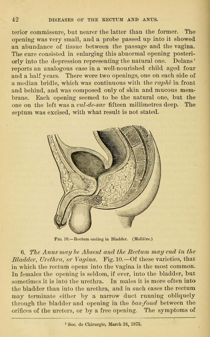 terior commissure, but nearer the latter than the former. The opening was very small, and a probe passed up into it showed an abundance of tissue between the passage and the vagina. The cure consisted in enlarging this abnormal opening posteri- orly into the depression representing the natural one. Delans' reports an analogous case in a well-nourished child aged four and a half years. There were two openings, one on each side of a median bridle, which was continuous with the raphe in front and behind, and was composed only of skin and mucous mem- brane. Each opening seemed to be the natural one, but the one on the left was a cul-de-sac fifteen millimetres deep. The septum was excised, with what result is not stated. FlG. 10.—Rectum ending in Bladder. (Molliere.) 6. Tfie Anus may be Absent and the Rectum may end in the Bladder, Urethra, or Vagina. Fig. 10.—Of these varieties, that in which the rectum opens into the vagina is the most common. In females the opening is seldom, if ever, into the bladder, but sometimes it is into the urethra. In males it is more often into the bladder than into the urethra, and in such cases the rectum may terminate either by a narrow duct running obliquely through the bladder and opening in the bas-fond between the orifices of the ureters, or by a free opening. The symptoms of 1 Soc. de Chirurgie, March 24, 1875.