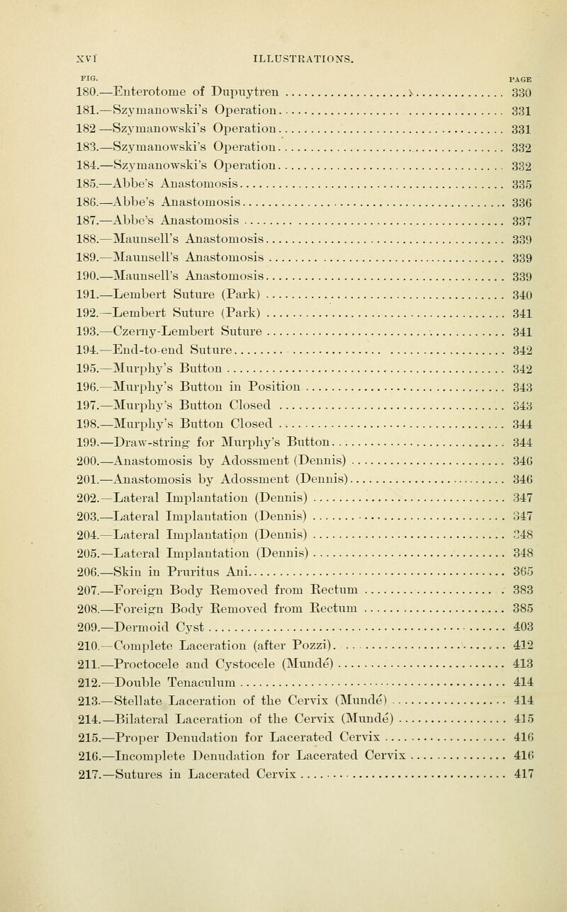 FIG. PAGE 180.—Enterotome of Dupuytren i^ 330 181.—Szymanowski's Operation 331 182 —Szymanowski's Operation 331 183.—Szymanowski's Operation 332 184.—Szymanowski's Operation 332 185.—Abbe's Anastomosis 335 186.—Abbe's Anastomosis 336 187.—Abbe'B Anastomosis 337 188.—Mauusell's Anastomosis 339 189.—Maunseli's Anastomosis 339 190.—Maunseli's Anastomosis 339 191.—Lembert Suture (Park) 340 192.—Lembert Suture (Park) 341 193.—Czerny-Lembert Suture 341 194.—Encl-to-encl Suture 342 195.—Murphy's Button 342 196.—Murphy's Button in Position 343 197.—Murphy's Button Closed 343 198.—Murphy's Button Closed 344 199.—Draw-string- for Murphy's Button 344 200.—Anastomosis by Adossment (Dennis) 340 201.—Anastomosis by Adossment (Dennis) 346 202.—Lateral Implantation (Dennis) 347 203.—Lateral Implantation (Dennis) . 347 204.—Lateral Implantation (Dennis) C48 205.—Lateral Implantation (Dennis) 348 206.—Skin in Pruritus Aui 365 207.—Foreign Body Kemoved from Kectum . 883 208.—Poreign Body Eemoved from Eectum 385 209.—Dermoid Cyst 403 210.—Complete Laceration (after Pozzi) , .. 412 211.—Proctocele and Cystocele (Munde) 413 212.—Double Tenaculum 414 213.—Stellate Laceration of the Cervix (Munde) 414 214.—Bilateral Laceration of the Cervix (Munde) 415 215.—Proper Denudation for Lacerated Cervix 416 216.—Incomplete Denudation for Lacerated Cervix 416 217.—Sutures in Lacerated Cervix 417