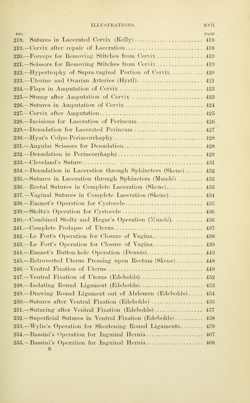 FIG. PAGE 218. Sutures in Lacerated Cervix (Kelly) 418 219.—Cervix after repair of Laceration 418 220.—Forceps for Eemoving- Stitches from Cervix 419 221.—Scissors for Eemoving- Stitclies from Cervix 419 222.—Hypertropliy of Supra-vaginal Portion of Cervix 420 223.—Uterine and Ovarian Arteries (Hyrtl) 421 224.—Flaps in Amputation of Cervix 423 225.—Stump after Amputation of Cervix 423 226.—Sutures in Amputation of Cervix 424 227.—Cervix after Amputation 425 228.—Incisions for Laceration of Perineum 426 229.—Denudation for Lacerated Perineum 427 230.—Hyar's Colpo-Perineorrhapliy 428 231.—Angular Scissors for Denudation 428 232.—Denudation in Ferineorrliaphy 429 233.—Cleveland's Suture 431 234.—Denudation in Laceration through Sphincters (Skene) 432 235.—Sutures in Laceration through Sphincters (Munde) 433 236.—Rectal Sutures in Complete Laceration (Skene) 433 237.—Vaginal Sutures in Complete Laceration (Skene) 434 238.—Emmet's Operation for Cystocele 435 239.—Stoltz's Operation for Cystocele 436 240.—Combined Stoltz and Hegar's Operation (Munde) 436 241.—Complete Prolapse of Uterus 437 242.—Le Fort's Operation for Closure of Vagina 438 243.—Le Fort's Operation for Closure of Vagina 439 244.—Emmet's Button-hole Operation (Dennis) 443 245.—Betroverted Uterus Pressing upon Rectum (Skene) 448 246.—Ventral Fixation of Uterus 449 247.—Ventral Fixation of Uterus (Edebohls) 452 248.—Isolating Round Ligament (Edebohls) 453 249.—Drawing Round Ligament out of Abdomen (Edebohls) 454 250.—Sutures after Ventral Fixation (Edebohls) 458 251.—Suturing after Ventral Fixation (Edebohls) 457 252.—Superficial Sutures in Ventral Fixation (Edebohls) 458 253.—Wylie's Operation for Shortening Round Ligaments 459 254.—Bassini's Operation for Inguinal Hernia 467 255. —Bassini's Operation for Inguinal Hernia 468