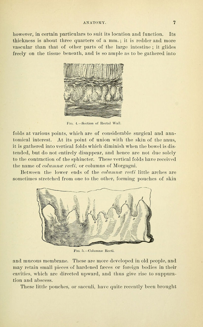 however, in certain particulars to suit its location and function. Its thickness is about three quarters of a mm.; it is redder and more vascular than that of other parts of the large intestine ; it glides freely on the tissue beneath, and is so ample as to be gathered into Fig. 4.—Section of Rectal Wall. folds at various points, which are of considerable surgical and ana- tomical interest. At its point of union with the skin of the anus, it is gathered into vertical folds which diminish when the bowel is dis- tended, but do not entirely disappear, and hence are not due solely to the contraction of the sphincter. These vertical folds have received the name of columncB rectU or columns of Morgagni. Between the lower ends of the columncB recti little arches are sometimes stretched from one to the other, forming pouches of skin Fig. 5.—Columnse Recti. and mucous membrane. These are more developed in old people, and may retain small pieces of hardened faeces or foreign bodies in their oavities, which are directed upward, and thus give rise to suppura- tion and abscess. These little pouches, or sacculi, have quite recently been brought