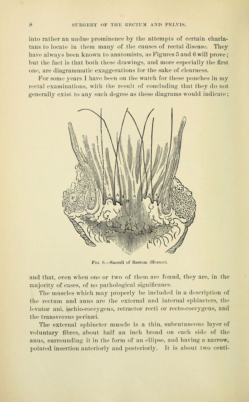 into rather an undue prominence by the attempts of certain charla- tans to locate in them many of the causes of rectal 9.isease. They have always been known to anatomists, as Figures 5 and 6 will prove ; but the fact is that both these drawings, and more especially the first one, are diagrammatic exaggerations for the sake of clearness. For some years I have been on the watch for these poaches in my rectal examinations, with the result of concluding that they do not generally exist to any such degree as these diagrams would indicate; Fig. 6.—Sacculi of Rectum (Hnrner). and that, even when one or two of them are found, they are, in the majority of cases, of no pathological significance. The muscles which may properly be included in a description of the rectum and anus are the external and internal sphincters, the levator ani, ischio-coccygeus, retractor recti or recto-coccygeus, and the transversus perinsei. The external sphincter muscle is a thin, subcutaneous layer of voluntary fibres, about half an inch broad on each side of the anus, surrounding it in the form of an ellipse, and having a narrow, pointed insertion anteriorly and posteriorly. It is about two centi-