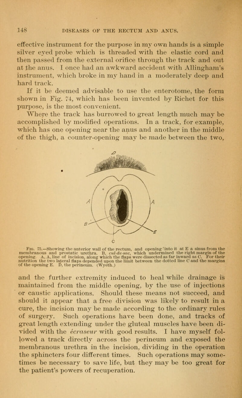 effective instrument for the purpose in iny own hands is a simple silver eyed probe which is threaded with the elastic cord and then passed from the external orifice through the track and out at the anus. I once had an awkward accident with Allingham's instrument, which broke in my hand in a moderately deep and hard track. If it be deemed advisable to use the enterotome, the form shown in Fig. 74, which has been invented by Richet for this purpose, is the most convenient. Where the track has burrowed to great length much may be accomplished by modified operations. In a track, for example, which has one opening near the anus and another in the middle of the thigh, a counter-opening may be made between the two. Fig. 75.—Showing the anterior wall of the rectum, and opening 'into it at E a sinus fi-om the menobranous and prostatic urethra. B, cul-de-sac, which undermined the right margin of the opening. A, A, line of incision, along which the flaps were dissected as far inward as C. For their nutrition the two lateral flaps depended upon the limit between the dotted line C and the margins of the opening E. t), the perineiun. (Wyeth.) and the further extremitj' induced to heal while drainage is maintained from the middle opening, by the use of injections or caustic applications. Should these means not succeed, and should it appear that a free division was likely to result in a cure, the incision may be made according to the ordinary rules of surgery. Such operations have been done, and tracks of great length extending under the gluteal muscles have been di- vided with the ecraseirr with good results. I have myself fol- lowed a track directly across the perineum and exposed the membranous urethra in the incision, dividing in the operation the sphincters four different times. Such operations may some- times be necessary to save life, but they may be too great for the patient's powers of recuperation.