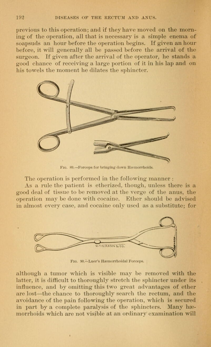 previous to this operation; and if they have moved on the morn- ing of the operation, all that is necessary is a simple enema of soapsuds an hour before the operation begins. If given an hour before, it will generally all be passed before the arrival of the surgeon. If given after the arrival of the operator, he stands a good chance of receiving a large portion of it in his lap and on his towels the moment he dilates the sphincter. Fig. 89.—Forceps for Ijriuging down Ha'inorrhoids. The operation is performed in the following manner : As a rule the patient is etherized, though, unless there is a good deal of tissue to be removed at the verge of the anus, the operation may be done with cocaine. Ether should be advised in almost every case, and cocaine only used as a substitute; for Fig. 90.—Lner's Hfemorrhoidal Forceps. although a tumor which is visible may be removed with the latter, it is difficult to thoroughly stretch the sphincter under its influence, and by omitting this two great advantages of ether are lost—the chance to thoroughly search the rectum, and the avoidance of the pain following the operation, which is secured in part by a complete paralysis of the sphincters. Many hae- morrhoids which are not visible at an ordinary examination will