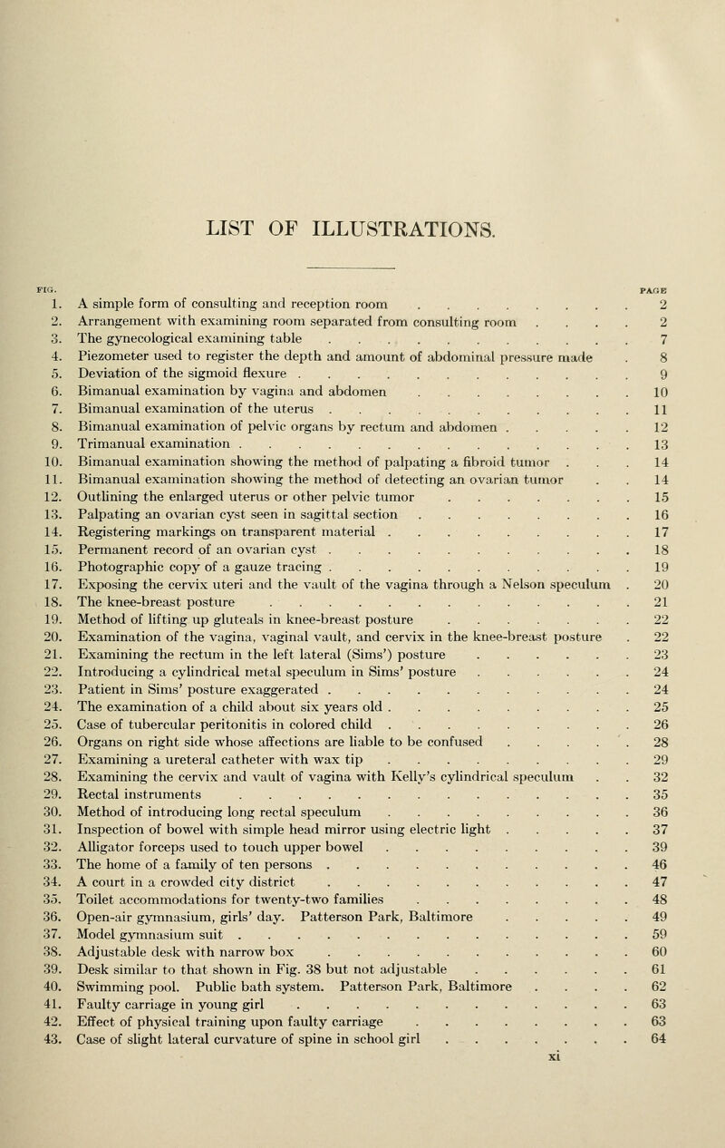 LIST OF ILLUSTRATIONS. FIG. PAXJB 1. A simple form of consulting and reception room 2 2. Arrangement with examining room separated from consulting room .... 2 3. The gynecological examining table 7 4. Piezometer used to register the depth and amount of abdominal pressure made . 8 5. Deviation of the signaoid flexure 9 6. Bimanual examination by vagina and abdomen 10 7. Bimanual examination of the uterus 11 8. Bimanual examination of pelvic organs by rectum and abdomen 12 9. Trimanual examination 13 10. Bimanual examination showing the method of palpating a fibroid tumor ... 14 11. Bimanual examination showing the method of detecting an ovarian tumor . . 14 12. Outlining the enlarged uterus or other pelvic tumor 15 13. Palpating an ovarian cyst seen in sagittal section 16 14. Registering markings on transparent material . . 17 15. Permanent record of an ovarian cyst 18 16. Photographic copy of a gauze tracing 19 17. Exposing the cervix uteri and the vault of the vagina through a Nelson speculum . 20 18. The knee-breast posture 21 19. Method of lifting up gluteals in knee-breast posture .22 20. Examination of the vagina, vaginal vault, and cervix in the knee-breast posture . 22 21. Examining the rectum in the left lateral (Sims') posture 23 22. Introducing a cylindrical metal speculum in Sims' posture 24 23. Patient in Sims' posture exaggerated 24 24. The examination of a child about six years old 25 25. Case of tubercular peritonitis in colored child 26 26. Organs on right side whose affections are liable to be confused . . . . . 28 27. Examining a ureteral catheter with wax tip 29 28. Examining the cervix and vault of vagina with Kelly's cylindrical speculum . . 32 29. Rectal instruments 35 30. Method of introducing long rectal speculum 36 31. Inspection of bowel with simple head mirror using electric light 37 32. Alligator forceps used to touch upper bowel 39 33. The home of a family of ten persons 46 34. A court in a crowded city district 47 35. Toilet accommodations for twenty-two families 48 36. Open-air gymnasium, girls' day. Patterson Park, Baltimore 49 37. Model gymnasium suit 59 38. Adjustable desk with narrow box 60 39. Desk similar to that shown in Fig. 38 but not adjustable 61 40. Swimming pool. Public bath system. Patterson Park, Baltimore .... 62 41. Faulty carriage in young girl 63 42. Effect of physical training upon faulty carriage 63 43. Case of slight lateral curvature of spine in school girl 64