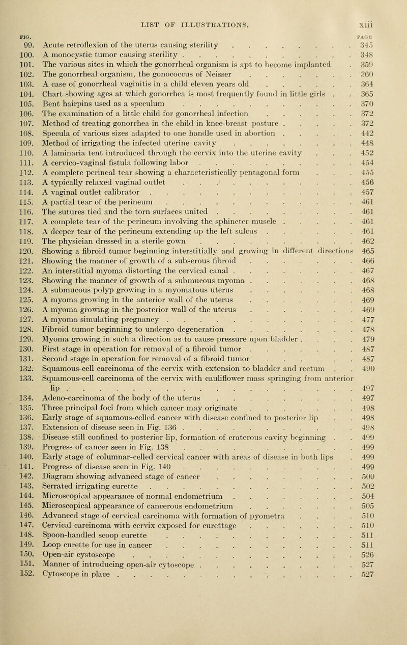 FIG. PAGE 99. Acute retroflexion of the uterus causing sterility 34.3 100. A monocystic tumor causing sterility 348 101. The various sites in which the gonorrheal organism is apt to become implanted . 350 102. The gonorrheal organism, the gonococcus of Neisser .360 103. A case of gonorrheal vaginitis in a child eleven years old .364 104. Chart showing ages at which gonorrhea is most frequently found in little girls . . .365 105. Bent hairpins used as a speculum 370 106. The examination of a little child for gonorrheal infection 372 107. Method of treating gonorrhea in the child in knee-breast posture .372 108. Specula of various sizes adapted to one handle used in abortion 442 109. Method of irrigating the infected uterine cavity 448 110. A laminaria tent introduced through the cervix into the uterine cavity . . . 452 111. A cervico-vaginal fistula following labor 454 112. A complete perineal tear showing a characteristically pentagonal form . . . 455 113. A typically relaxed vaginal outlet . . 456 114. A vaginal outlet calibrator 4.57 115. A partial tear of the perineum 461 116. The sutures tied and the torn surfaces united 461 117. A complete tear of the perineum involving the sphincter muscle 461 118. A deeper tear of the perineum extending up the left sulcus 461 119. The physician dressed in a sterile gown 462 120. Showing a fibroid tumor beginning interstitially and growing in different directions 465 121. Showing the manner of growth of a subserous fibroid 466 122. An interstitial myoma distorting the cervical canal 467 123. Showing the manner of growth of a submucous myoma 468 124. A submucous polyp growing in a myomatous uterus 468 125. A myoma growing in the anterior wall of the uterus . • 469 126. A myoma growing in the posterior wall of the uterus 469 127. A myoma simulating pregnancy 477 128. Fibroid tumor beginning to undergo degeneration 478 129. Myoma growing in such a direction as to cause pressure upon bladder .... 479 130. First stage in operation for removal of a fibroid tumor 487 131. Second stage in operation for removal of a fibroid tumor 487 132. Squamous-cell carcinoma of the cervix with extension to bladder and rectum . . 490 133. Squamous-cell carcinoma of the cervix with cauliflower mass springing from anterior lip 497 134. Adeno-carcinoma of the body of the uterus 497 135. Three principal foci from which cancer may originate 498 136. Early stage of squamous-celled cancer with disease confined to posterior lip . . 498 137. Extension of disease seen in Fig. 136 498 138. Disease still confined to posterior lip, formation of craterous cavity beginning . . 499 139. Progress of cancer seen in Fig. 138 499 140. Early stage of columnar-celled cervical cancer with areas of disease in both lips . 499 141. Progress of disease seen in Fig. 140 499 142. Diagram showing advanced stage of cancer 500 143. Serrated irrigating curette 502 144. Microscopical appearance of normal endometrium 504 145. Microscopical appearance of cancerous endometrium 505 146. Advanced stage of cervical carcinoma with formation of pyometra .... 510 147. Cervical carcinoma with cervix exposed for curettage 510 148. Spoon-handled scoop curette 511 149. Loop curette for use in cancer 511 150. Open-air cystoscope 526 151. Manner of introducing open-air cytoscope 527 152. Cytoscope in place 527