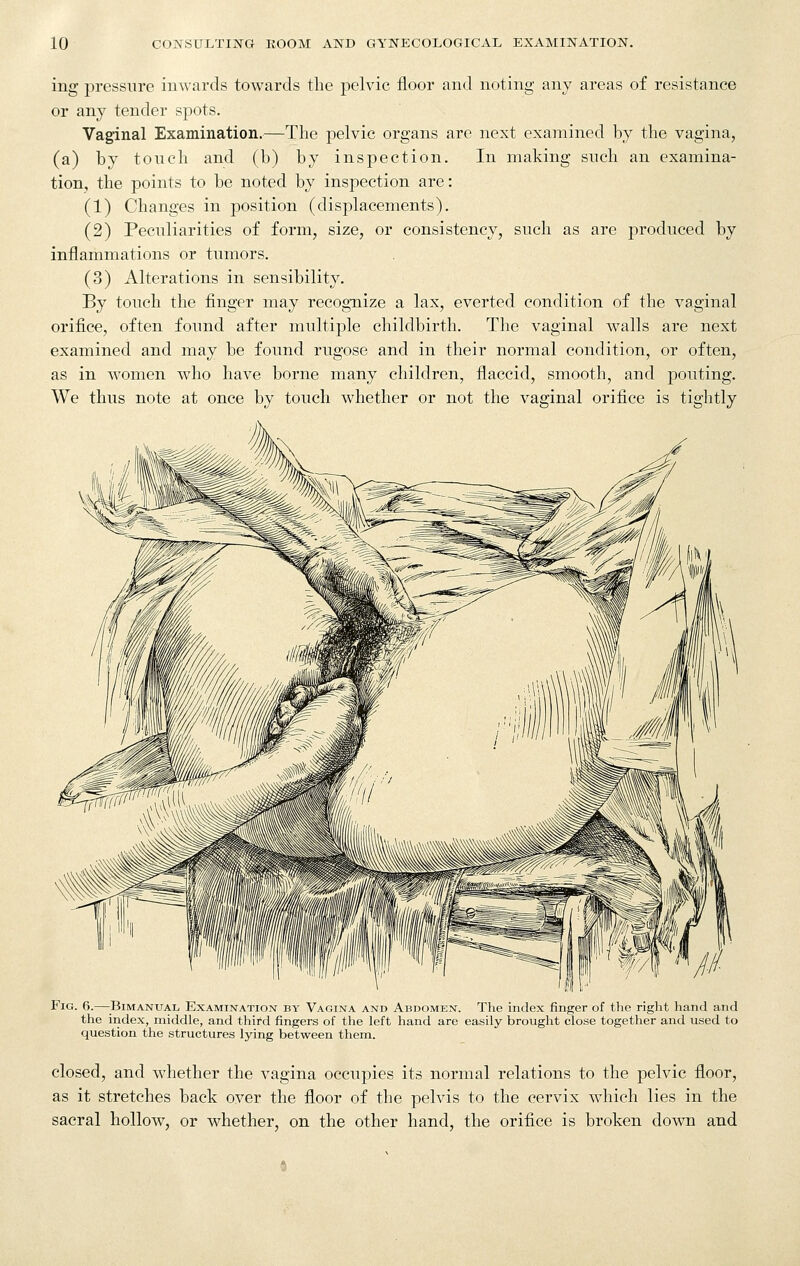 ing pressure inwards towards the pelvic floor and noting any areas of resistance or any tender spots. Vaginal Examination.—The pelvic organs are next examined by the vagina, (a) by tonch and (b) by inspection. In making snch an examina- tion, the points to be noted by inspection are: (1) Changes in position (displacements). (2) Peculiarities of form, size, or consistency, such as are produced by inflammations or tumors. (3) Alterations in sensibility. By touch the finger may recognize a lax, everted condition of the vaginal orifice, often found after multiple childbirth. The vaginal walls are next examined and may be found rugose and in their normal condition, or often, as in women who have borne many children, flaccid, smooth, and pouting. We thus note at once by touch whether or not the vaginal orifice is tightly Fig. 6.—^Bimanual Examination by Vagina and Abdomen. The index finger of the right hand and the index, middle, and third fingers of the left hand are easily brought close together and used to question the structures lying between them. closed, and whether the vagina occupies its normal relations to the pelvic floor, as it stretches back oyer the floor of the pelvis to the cervix wdiich lies in the sacral hollow, or whether, on the other hand, the orifice is broken down and