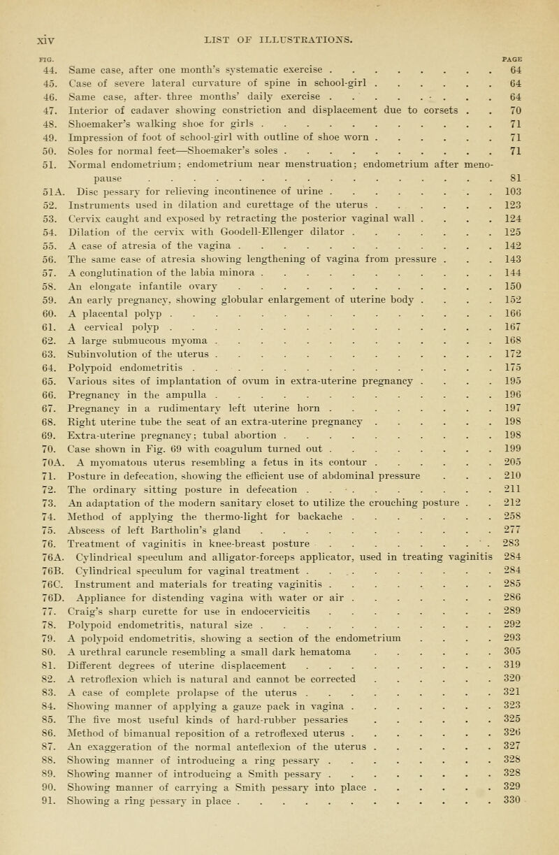 FIG. PAGE 44. Same case, after one month's systematic exercise 64 45. Case of severe lateral curvature of spine in schoolgirl 64 46. Same case, after, three months' daily exercise - . . .64 47. Interior of cadaver showing constriction and displacement due to corsets . . 70 48. Shoemaker's walking shoe for girls 71 49. Impression of foot of school-girl with outline of shoe worn 71 50. Soles for normal feet—Shoemaker's soles 71 51. Normal endometrium: endometrimu near menstruation; endometrium after meno- pause 81 51A. Disc pessary for relieving incontinence of urine 103 52. Instruments used in dilation and curettage of the uterus 123 53. Cervix caught and exposed by retracting the posterior vaginal wall .... 124 54. Dilation of the cervix with Goodell-Ellenger dilator 125 55. A case of atresia of the vagina 142 56. The same ease of atresia showing lengthening of A'agina from pressure . . . 143 57. A conglutination of the labia minora 144 58. An elongate infantile ovary 150 59. An early pregnancy, showing globular enlargement of uterine body .... 152 60. A placental polyi^ 166 61. A cervical polyp 167 62. A large submucous myoma 168 63. Subinvolution of the uterus 172 64. Polypoid endometritis 175 65. Various sites of implantation of ovum in extra-uterine pregnancy .... 195 66. Pi'egnancy in the ampulla 196 67. Pregnancy in a rudimentary left uterine horn 197 68. Right uterine tube the seat of an extra-uterine pregnancy 198 69. Extra-uterine pregnancy; tubal abortion 198 70. Case shown in Fig. 69 with coagulum turned out 199 70A. A myomatous uterus resembling a fetus in its contour 205 71. Posture in defecation, showing the efficient use of abdominal pressure . . . 210 72. The ordinary sitting posture in defecation . 211 73. An adaptation of the modern sanitary closet to utilize the crouching posture . . 212 74. Method of applying the tliermo-light for backache 258 75. Abscess of left Bartholin's gland 277 76. Treatment of vaginitis in knee-breast posture 283 76A. Cylindrical speculum and alligator-forceps applicator, used in treating vaginitis 284 76B. Cylindrical speculum for vaginal treatment . . 284 76C. Instrument and materials for treating vaginitis 285 76D. Appliance for distending vagina with water or air 286 77. Craig's sharp curette for use in endocervicitis 289 78. Polypoid endometritis, natural size 292 79. A polypoid endometritis, showing a section of the endometrium .... 293 80. A urethral caruncle resembling a small dark hematoma 305 81. Different degrees of uterine displacement 319 82. A retroflexion which is natural and cannot be corrected 320 83. A case of complete prolapse of the uterus 321 84. Showing manner of applying a gauze pack in vagina 323 85. The five most useful kinds of hard-rubber pessaries 325 86. Method of bimanual reposition of a retroflexed uterus 326 87. An exaggeration of the normal anteflexion of the uterus 327 88. Showing manner of introducing a ring pessary 328 89. Showing manner of introducing a Smith pessary 328 90. Showing manner of carrying a Smith pessary into place 329 91. Showing a ring pessary in place 330