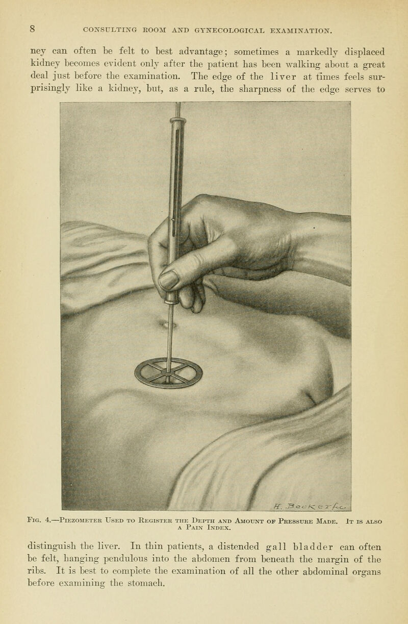 ney can often be felt to best advantage; sometimes a markedly displaced kidney becomes evident only after the patient has been walking about a great deal just before the examination. The edge of the liver at times feels sur- prisingly like a kidney, but, as a rule, the sharpness of the edge serves to Fig. 4.—Piezometer Used to Register the Depth and Amount op Pressure Made. It is also A Paix Index. distinguish the liver. In thin patients, a distended gall bladder can often be felt, hanging pendulous into the abdomen from beneath the margin of the ribs. It is best to complete the examination of all the other abdominal organs before examining the stomach.