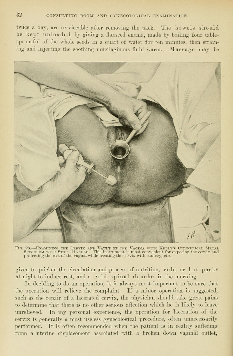twice a clay, are serviceable after removing the pack. The bowels should be kept unloaded bv giving a flaxseed enema, made by boiling four table- spoonsful of the whole seeds in a quart of water for ten minutes, then strain- ing and injecting the soothing mucilaginous fluid warm. Massage may be Fig. 28.—ExA^^xrN■G tete CER^^x and Vattlt of tfte Vagixa with Kellt's O-ltxdrical Metal SpecultjM with Stout H.andle. This instninient is most convenient for exposing the cervix and protecting the rest of the vagina wliile treating the cer\dx with canterj-, etc. given to quicken the circulation and process of nutrition, cold or hot packs at night to induce rest, and a cold spinal douche in the morning. In deciding to do an operation, it is always most important to be sure that the operation will relieve the complaint. If a minor operation is suggested, such as the repair of a lacerated cervix, the physician should take gTeat pains to determine that there is no other serious affection which he is likely to leave unrelieved. In my personal experience, the operation for laceration of the cervix is generally a most useless gynecological procedure, often unnecessarily performed. It is often recommended when the patient is in reality suffering from a uterine displacement associated with a broken down vaginal outlet,