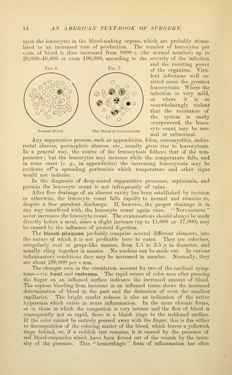 upon the leucocytes in tlie blood-iuiikinf]; organs, which arc probably stimu- lated to an increased rate of production. The number of leucocytes jier c.cm. of blood is thus increased from HUGO ± (the normal number) up to 20,000-40,000 or even 100,000, according to the severity of the infection and the resisting power ''^*- ^- ^■' '^- of the organism. Viru- lent infections well re- sisted cause the greatest leucocytosis. Where the infection is very mild, or where it is so overwhelmingly violent that the resistance of the system is easily overpowered, the leuco- , T., , rrv. 1,1 , 1 . ■ cyte count may be nor- Normal Blood. The Blood in Leucocvtosis. ^ , , -^ , mal or subnormal. Any suppurative process, such as appendicitis, felon, osteomyelitis, ischio- rectal abscess, perinephric abscess, etc., usually gives rise to leucocytosis. In a general way, the course of the leucocytosis follows that of the tem- perature ; but the leucocytes may increase while the temperature falls, and in some cases {e. ^., in appendicitis) the increasing leucocytosis may be evidence of* a spreading peritonitis which temperature and other signs would not indicate. In the diagnosis of deep-seated suppurative processes, septicemia, and pyemia the leucocyte count is not infre(|uently of value. After free drainage of an abscess cavity has been established by incision or otherwise, the leucocyte count falls rapidly to normal and remains so, despite a free purulent discharge. If, however, the proper drainage is in any Avay interfered with, the leucocyte count again rises. Nervousness never increases the leucocyte count. The examinations should always be made directly before a meal, since a slight increase (up to 15,000 or 17.000) may be caused by the influence of proteid digestion. The blood-plaques probably comprise several different elements, into the nature of Avhich it is not profitable here to enter. They are colorless, irregularly oval or grape-like masses, from 1.5 to 3.5 fx in diameter, and usually cling together in masses. No nucleus can be made out. In various inflammatory conditions they may be increased in number. Normally, they are about 200,000 per c.mm. The changes seen in the circulation account for two of the cardinal symp- toms—viz. heat and redness. The rapid return of color seen after pressing the finger on an inflamed surface indicates the increased amount of blood. The copious bleeding from incisions in an inflamed tissue shows the increased detei'mination of blood to the part and the distention of even the smallest capillaries. The bright scarlet redness is also an indication of the active hyperemia Avhich exists in acute inflammation. In the more chronic forms, or in those in which the congestion is very intense and the flow of blood is consequently not so rapid, there is a bluish tinge to the reddened surface. If the color cannot be entirely pressed away Avith the finger, this is due either to decomposition of the coloring matter of the blood, which leaves a yellowish tinge behind, or, if a reddish tint remains, it is caused by the presence of red blood-corpuscles which have been forced out of the vessels by the inten- sity of the pressure. This hemorrhagic form of inflammation has often