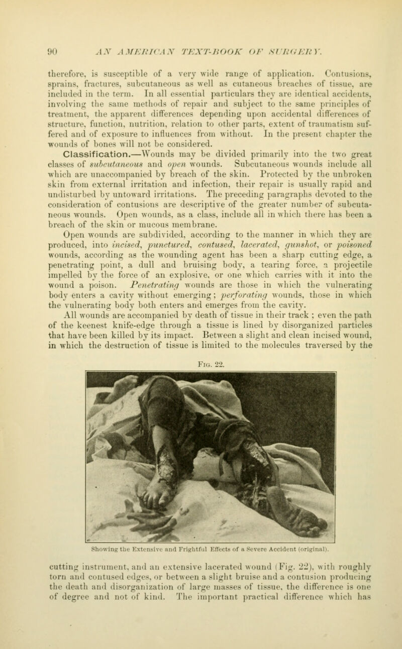 tlierefore, is susceptible of a very wide range of application. Contusions, sprains, fractures, subcutaneous as well as cutaneous breaches of tissue, are included in the term. In all essential particulars they are identical accidents, involving the same methods of repair and subject to the same principles of treatment, the apparent differences depending upon accidental differences of structure, function, nutrition, relation to other parts, extent of traumatism suf- fered and of exposure to intiuences from without. In the present chapter the ■wounds of bones will not be considered. Classification.—Wounds may be divided primarily into the two great classes of subcutaneous and open wounds. Subcutaneous wounds include all which are unaccompanied by breach of the skin. Protected by the unbroken skin from external irritation and infection, their repair is usually rapid and undisturbed by untoward irritations. The preceding paragraphs devoted to the consideration of contusions are descriptive of the greater number of subcuta- neous wounds. Open wounds, as a class, include all in which there has been a breach of the skin or mucous membrane. Open wounds are subdivided, according to the manner in which they are produced, into incised, punctured, contused, lacerated, gunshot, or poisoned wounds, according as the wounding agent has been a sharp cutting edge, a penetrating point, a dull and bruising body, a tearing force, a projectile impelled by the force of an explosive, or one which carries with it into the wound a poison. Penetrating wounds are those in which the vulnerating body enters a cavity without emerging; perforating wounds, those in which the vulnerating body both enters and emerges from the cavity. All wounds are accompanied by death of tissue in their track ; even the path of the keenest knife-edge through a tissue is lined by disorganized particles that have been killed by its impact. Between a slight and clean incised wound, in which the destruction of tissue is limited to the molecules traversed by the Fig. 22. Showing the Extensive and Frightful Effects of a Severe Accident (originali. cutting instrument, and an extensive lacerated wound (Fig. 'I'l), with roughly torn and contused edges, or between a slight bruise and a contusion producing the death and disorganization of large masses of tissue, the diff'crence is one of degree and not of kind. The important practical difference which has