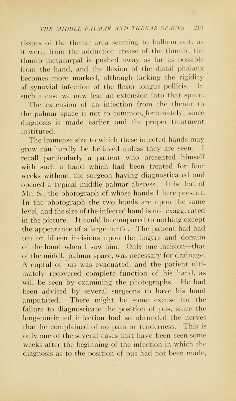 Tin: M/nniJ. r//ai ir /\i> r///:\./k si'ic/.s _'l'.i li>siics (il llic llicii.ir .irc;i ^(•ciiiiiiL: '•' l».ill<>')ii diil, .1-- il were, iVoiii llic ;i(l(lii( lioii crcax' (»l lln' iliiiiiili; llif lluiiiil) mclacarpal i^ i)iislic(l a\\a\ as lai as possil^lc Iroin tlu' hand, and llu- flexion of tlic distal i)halanx beconic's more niarkc-d. althoui^li lackin.u, the rii;idit>' of synovial infection of the llexoi' lon.^us pollieis. In such a case we now fear an extension into that si)ace. The extension of an infection Ironi the llienar to the i)almar space is not so common, fortunately, since diatiuosis is made earlier and the i)r()per treatment instituted. The immense vsize to which these infected hands may i2,row can hardly be believed unless they are seen. I recall particularly a patient who presented himself with such a hand which had been treated for four weeks without the surgeon having diagnosticated and opened a typical middle palmar abscess. It is that of Mr. S., the photograi)h of whose hands I here present. In the photograph the two hands are upon the same level, and the size of the infected hand is not exaggerated in the picture. It could be compared to nothing except the appearance of a large turtle. The patient had had ten or fifteen incisions upon the fingers and dorsum of the hand when I saw him. Only one incision—that of the middle i)almar space, was necessar>- for drainage. A cupful of pus was evacuated, and the patient ulti- mately recovered complete function of his hand, as will be seen by examining the photographs. He had been adx'ised by several surgeons to ha\'e his hand ^imputated. There might be some excuse lor the failure to diagnosticate the position of i)us, since the long-continued infection had so ol)tunded the nerves that he complained of no pain or tenderness. This is onh' one of the several cases that have been seen some weeks after the beginning of the infection in which tlie diagnosis as to the position of pus had not lieen nuuK',