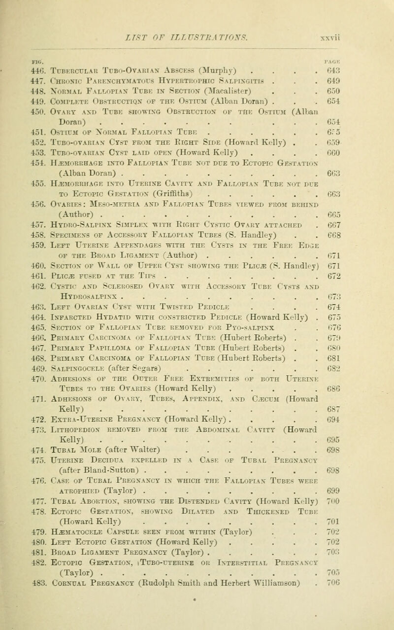 FIG. 44G. TuBKRCULAU TuBo-OvARiAX Abscess (Murphy) 447. C'HKONIC PAliKXCHYMATuUS HVPERTRfiPHIC SaLI'IXGITIS . 448. Normal Fallopian' Tcbk in Section Qlacalister) 449. Ck)MPLKTE Obstkcctiqx uf the Ostioi (Alban Doran) . 450. Ovary and Tcbe showing Obstbcctiox of the Ostiuji (-A-lban Doran) ....... . . 451. OsTiuii op Normal Fallopian Tcbi: ..... 452. Tcbo-ovarian Ctst from the Eight Side (Howarfl Kelly) . 453. TcBO-ovARiAN Cyst laid open (Howard Kelly) 454. HAEMORRHAGE INTO FaLLOPIAN TcBE NOT DUE TO ECTOPIC Ge.STATION (Alban Doran) ......... 455. HjiMORRHAGE INTO UtERINE CavITY AND FaLLOPIAN TuBE XoT DLE TO Ectopic Gestation (Griffiths) ..... 4.56. Ovaries: Mesooietria and Fallopian Tubes tiewed from behind (Author) .......... 457. Hydro-Salpinx Simplex with Right Cystic Ovary attached 458. SPECiiiENS of Accessory Fallopian Tubes (S. Handley) 459. Left Uterine Appendages with the Cysts in the Free Ed^e of the Broad Ligament (Author) ..... 460. Section of Wall of Upper Cyst showing the Plic^ (S. Handley) 461. Plics! fused at the Tips ....... 462. Cystic and Sclerosed Ovary with Accessory Tube Cysts and Hydrosalpinx ......... 463. Left Ovarian Cyst with Twisted Pedicle 464. Inparcted Hydatid with constricted Pedicle (Howard Kelly) 46.5. Section of Fallopian Tube removed for Pyo-salpinx 466. Primary Carcuxoma of Fallopian Tube (Hubert Pioberts) . 467. PRI3IARY Papilloma op Fallopian Tube (Hubert Eoberts) . 468. Primary Carcinoma of Fallopian Tube ^Hubert Eoberts) . 469. Salpingocele (after Segars) ...... 470. Adhesions of the Outer Free Extremities of both Uterine Tubes tii the Ovaries (Howard Kelly) .... 471. Adhesion^s of Ovary-, Tubes, Appendix, and C^cum (Howard Kelly) 472. Extra-Uterine Pregnancy (Howard Kelly) .... 473. Lithopedion removed from the Abdominal Cavity (Howard Kelly) 474. Tubal ^Iole (after Walter) 475. Uterine Decidua expelled in a Case of Tubal Pregx'ax'cy (after Bland-Sutton) ........ 476. Case op Tubal Pregnancy in which the Fallopian Tubes were atrophied (Taylor) . . 477. Tubal Abortion, showing the Distended Cavity (Howard Kelly) 478. Ectopic Gestation, sHOw^NG Dilated and Thickened Tubk (Howard Kelly) 479. H.s:matocele Capscle seen from within (Taylor) 480. Left Ectopic Gestation (Howard Kelly) .... 481. Broad Ligament Pregnancy (Taylor) ..... 482. Ectopic Gestation, iTcbo-uterine or Interstitial Pregnancy (Taylor) 483. CoRNUAL Pregnancy (Rudolph Smith and Herbert Williamson) PACK 643 649 650 654 654 6.^5 6.59 060 663 663 665 667 668 671 671 672 673 674 675 676 679 680 681 68ii 686 687 694 695 698 698 699 700 701 702 702 703 705 706