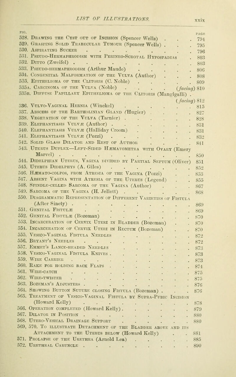 PAGE 794 795 796 803 803 806 808 809 ier) (Emery 528. Drawing the Cyst out of Inoibion (Spencer Wells) 529. Graspixg Sulib Tuabectjlai; Tumour (Spencer Wells) 530. Aspirating Sucker 531. Pseudo-Hermaphrodisji with Perineo-Sorotal Hypospadias 532. Ditto (Zweifel) 533. P.SEUDO-HERMAPHRODISJI (Arthur Maude) 534. Coxgkxital ^Malformation of the Vulva (Author) 535. Epithelioma of the Clitoris (0. Noble) . . . , 535a. Carcinoma op the Vulya (Noble) .... (facing) 810 535b. Diffuse Papillary Epithelioma of the Clitoris (Mangio'alli) (facing) 812 536. VuLVo-Vaginal Hernia (Winckel) 537. Abscess of the Bartholiniax Glaxd ^Hu; 538. Vegetation of the Vulva (Tarnier) . 539. Elephantiasis Vulv^ (Author) . 540. Elephantiasis Vulvae (Halliday Croom) 541. Elephantiasis Vulv^ (Pozzi) 542. Solid Glass Dilator and Rest of Author 543. Uterus Duplex—Left-Sided H^matometea with Ovary Marvel) . 544. DiDELPHiAN Uterus, Vagina divided by Partial Septum (Oliver) 545. Uterus Didelphys (A. Giles) ..... 546. H.SMATO-COLPOS, from Atresia of the Vagina (Pozzi) 547. Absent Vagina with Atresia op the Uterus (Legend) 548. Spindle-celled Sarcoma op the Vagina (Author) 549. Sarcoma op the Vagina (H. .Jellett) .... 550. Diagrammatic Representation of Different Varieties of Fistula (After Sinety) ........ 551. Genital Fistula ....... 552. Genital Fistula; (Bozeman) ..... 553. Incarceration of Cekvis Uteri in Bladder (Bozeman) 554. Incarceration of Cervix Uteri in Rectum (Bozeman) 555. Vesico-Vaginal Fistula Needles .... 556. Bryant's Needles ....... 557. Emmet's Lance-headed Needles .... 558. Vesico-Vaginal Fistula Knives 559. Wire Carrier 560. Rake for holding back Flaps 561. WnjE-CATCH 562. Wibe-twister 563. Bozeman's Adjusters . . 564. Showing Button Suture closing Fistula (Bozeman) 565. Treatment op Vesico-Vaginal Fistula by Supra-Pubic In( (Howard Kelly) .... 566. Operation completed (Howard Kelly) . 567. Dilator in Position .... 568. Utero-Vesical Drainage Support 569. 570. To illustrate Detachment of the Bladder above and its Attachment to the Uterus below (Howard Kelly) 571. Prolapse op the Urethra (Arnold Lea) 572. Urethral Caruncle ...... 815 827 828 831 831 832 841 850 851 852 853 855 867 868 869 869 870 870 870 872 872 873 873 873 874 875 875 876 876 878 879 880 880 881 885 890