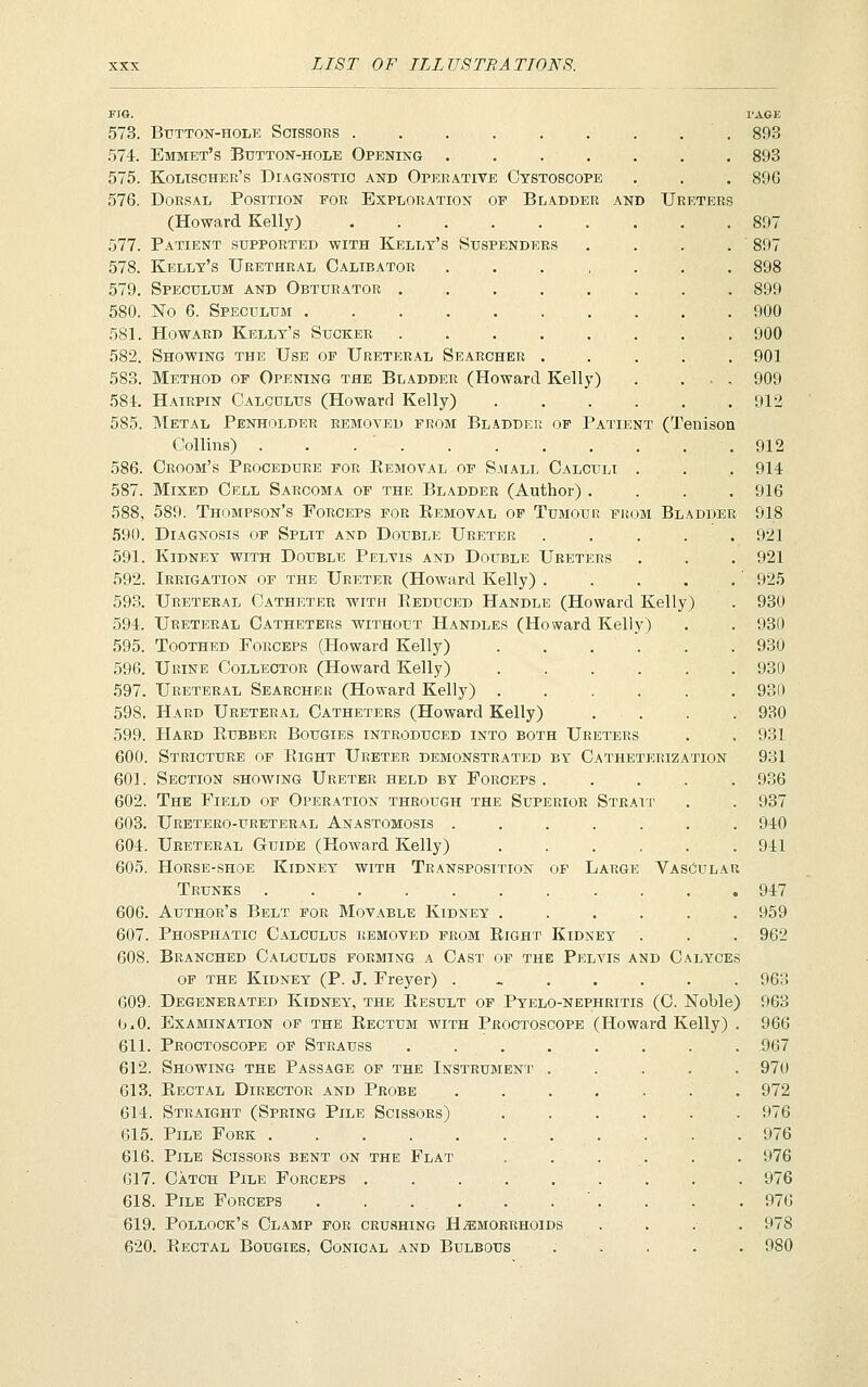 573. BtTTTON-HOLE SciSSOBS 574. Emmet's Button-hole Opening .... 575. Koltscher's Diagnostic and Operative Cystoscope 576. Dorsal Position foe Exploration of Bladder and Ureters (Howard Kelly) 577. Patient supported with Kelly's Suspenders 578. Kelly's Urethral Calibator . . . , 579. Speculum and Obturator ..... 580. No 6. Speculum 581. Howard Kelly's Sucker ..... 582. Showing the Use of Ureteral Searcher . 583. Method of Opening the Bladder (Howard Kelly) 584. Hairpin Calculus (Howard Kelly) 585. Metal Penholder removed from Bladder of Patient (Tenisoa Collins) ........ 586. Groom's Procedure for Kemoval op S.uall Calculi 587. Mixed Cell Sarcoma of the Bladder (Author) . 588. 589. Thompson's Forceps for Eemoval op Tumour from Bladder 590. Diagnosis op Split and Double Ureter .... 591. Kidney with Double Pelvis and Double Ureters 592. Irrigation op the Ureter (Howard Kelly) .... 593. Ureteral Catheter with Eeduced Handle (Howard Kelly) 594. Ureteral Catheters without Handles (Howard Kelly) 595. Toothed Forceps (Howard Kelly) ..... 596. Urine Collector (Howard Kelly) ..... 597. Ureteral Searcher (Howard Kelly) ..... 598. Hard Ureteral Catheters (Howard Kelly) 599. Hard Eubber Bougies introduced into both Ureters 600. Stricture op Eight Ureter demonstrated by Catheterization 601. Section showing Ureter held by Forceps .... 602. The Field of Operation through the Superior Strait 603. Uretero-ureteral Anastomosis ...... 604. Ureteral Guide (Howard Kelly) ..... 605. Horse-shoe Kidney with Transposition op Large VasOular Trunks ........... 600. Author's Belt for Movable Kidney ...... 607. Phosphatic Calculus removed from Eight Kidney 608. Branched Calculos forming a Cast op the Pelvis and Calyces OP THE Kidney (P. J. Freyer) ....... 609. Degenerated Kidney, the Eesult of Pyelo-nephritis (C. Noble) 0.0. Examination op the Eectum with Proctoscope (Howard Kelly) . 611. Proctoscope of Strauss 612. Showing the Passage of the Instrument 613. Eectal Director and Probe 614. Straight (Spring Pile Scissors) 615. Pile Fork 616. Pile Scissors bent on the Flat 617. Catch Pile Forceps . 618. Pile Forceps .... 619. Pollock's Clamp for crushing Hemorrhoids 620. Eectal Bougies, Conical and Bulbous I'AGE 893 893 896 807 897 898 899 900 900 901 909 912 912 914 916 918 921 921 ■ 925 930 930 930 930 931) 930 931 931 936 937 940 941 947 959 962 963 963 966 .967 970 972 976 976 976 976 , 976 978 , 980