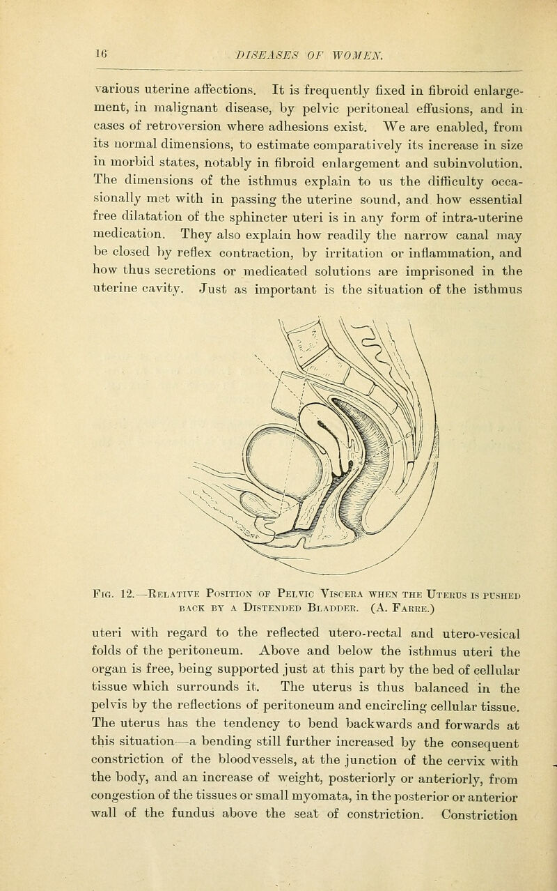 various uterine affections. It is frequently fixed in fibroid enlai'ge- ment, in malignant disease, by pelvic peritoneal effusions, and in- cases of retroversion where adhesions exist. We are enabled, from its normal dimensions, to estimate comparatively its increase in size in morbid states, notably in fibroid enlargement and subinvolution. The dimensions of the isthmus explain to us the diflficulty occa- sionally met with in passing the uterine sound, and how essential free dilatation of the sphincter uteri is in any form of intra-uterine medication. They also explain how readily the narrow canal may be closed by reflex contraction, by irritation or inflammation, and how thus secretions or medicated solutions are imprisoned in the uterine cavity. Just as important is the situation of the isthmus Fig. 12.—Relative Position of Pelvic Viscera when the Uteeus is pushed BACK BY A Distended Bladder. (A. Farre.) uteri with regard to the reflected utero-rectal and utero-vesical folds of the peritoneum. Above and below the isthmus uteri the organ is free, being supported just at this part by the bed of cellular tissue which surrounds it. The uterus is thus balanced in the pelvis by the reflections of peritoneum and encircling cellular tissue. The uterus has the tendency to bend backwards and forwards at this situation—a bending still further increased by the consequent constriction of the bloodvessels, at the junction of the cervix with the body, and an increase of weight, posteriorly or anteriorly, from congestion of the tissues or small myomata, in the posterior or anterior wall of the fundus above the seat of constriction. Constriction