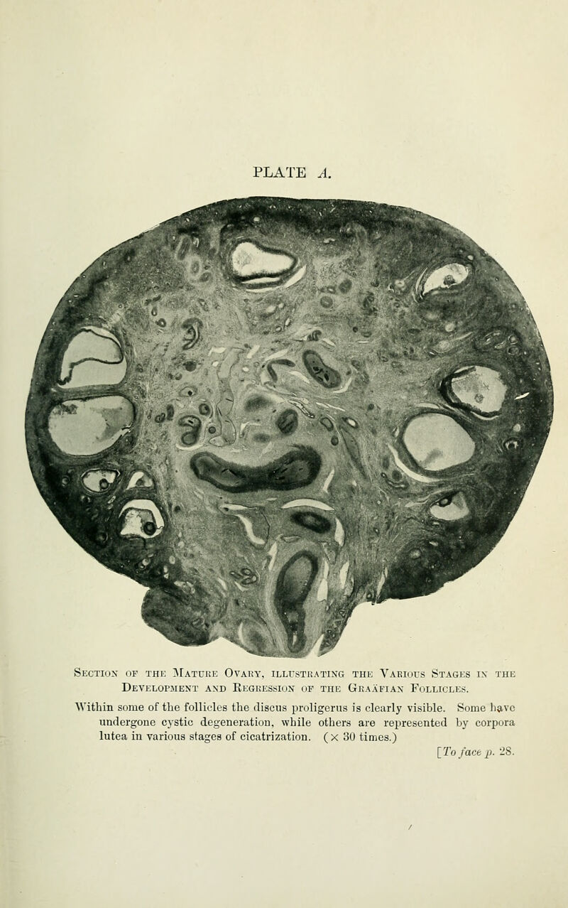 Skctiox of the INIatcke Ovaky, illustrating the Various Stages ix the Development and Kegression of the Graafian Follicles. Within some of the follicles the discus proligerus is clearly visible. Some ha^vc undergone cystic degeneration, while others are represented by corpora lutea in various stages of cicatrization, (x 30 times.) [To face p. 28.