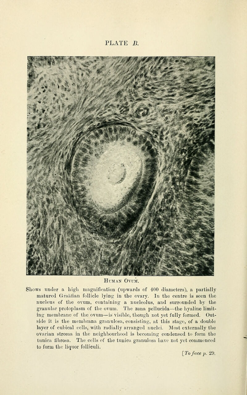 Human Ovum. Shows under a high magnification (upwards of 400 diameters), a partially matured Graafian follicle lying in the ovary. In the centre is seen the nucleus of the ovum, containing a nucleolus, and surrounded by the granular protoplasm of the ovum. The zona pellucida—the hyaline limit- ing membrane of the ovum—is visible, though not yet fully formed. Out- side it is the membrana granulosa, consisting, at this stage, of a double layer of cubical cells, with radially arranged nuclei. Most externally the ovarian stroma in the neighbourhood is becoming condensed to form the tunica fibrosa. The cells of the tunica granulosa have not yet commenced to form the liquor folliculi. lTofucep.2d.