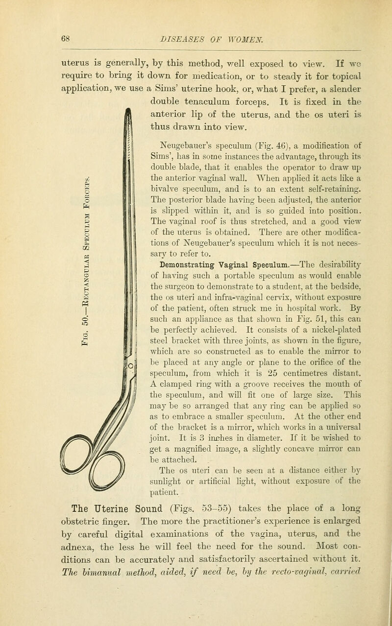 uterus is generally, by this method, well exposed to ^iew. If we require to bring it down for medication, or to steady it for topical application, we use a Sims' uterine hook, or, what I prefer, a slender double tenaculum forceps. It is fixed in the anterior lip of the uterus, and the os uteri is thus drawn into view. Neugebauer's speculum (Fig. 46), a modification of Sims', has in some instances the advantage, through its double blade, that it enables the operator to draw up the anterior vagiual wall. When applied it acts like a bivalve speculum, and is to an extent self-retaiaing. The posterior blade having been adjusted, the anterior is slipped within it, and is so guided into position. The vaginal roof is thus stretched, and a good view of the uterus is obtained. There are other modifica- tions of Neugebauer's speculum which it is not neces- sary to refer to. Demonstrating Vaginal Speculum.—The desirability of having such a portable speculum as would enable the surgeon to demonstrate to a student, at the bedside, the OS uteri and infra-vaginal cervix, without exposm'e of the patient, often struck me in hospital work. By such an appliance as that shown in Fig. 51, this can be perfectly achieved. It consists of a nickel-plated steel bracket with three joints, as shown in the figure, which are so constructed as to enable the mirror to be placed at any angle or plane to the orifice of the speculum, from which it is 25 centimetres distant. A clamped ring with a groove receives the mouth of the speculum, and will fit one of large size. This may be so arranged that any ring can be apphed so as to embrace a smaller speculum. At the other end of the bracket is a miiTor, which works in a universal joint. It is 3 inches in diameter. If it be wished to get a magnified image, a shghtly concave muTor can be attached. The OS uteri can be seen at a distance either by sunlight or artificial hght, without exposure of the patient. The Uterine Sound (Figs. 53-55) takes the place of a long obstetric finger. The more the practitioner's experience is enlarged by careful digital examinations of the vagina, uterus, and the adnexa, the less he will feel the need for the sound. Most con- ditions can be accurately and satisfactorily ascertained without it. The himanual method, aided, if need he, hy the recto-vaginal, carried