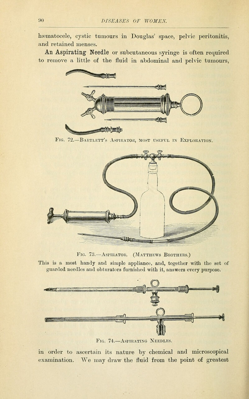hsematocele, cystic tumours in. Douglas' space, pelvic peritonitis, and retained menses. An Aspirating Needle or subcutaneous syringe is often required to remove a little of the fluid in abdominal and pelvic tumours, Fig. 72.—Bartlett's Aspirator, most useful in Exploeation. Fig. 73.—Aspirator. (Matthews Brothers.) This is a most handy and simple appliance, and, together with the set of guarded needles and obturators furnished with it, answers every purpose. Fig. 74.—Aspirating Needles. in order to ascertain its nature by chemical and microscopical examination. We may draw the fluid from the point of greatest